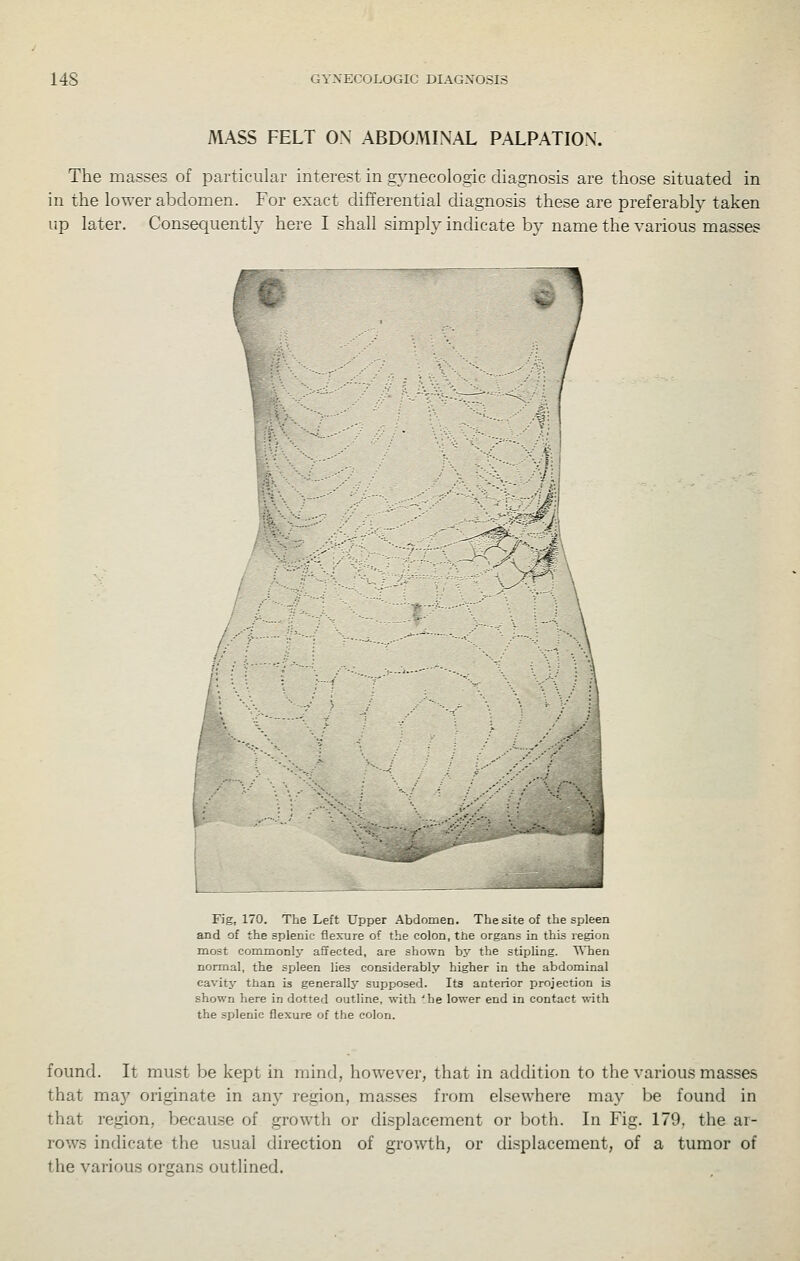 MASS FELT OX ABDOMINAL PALPATION. The masses of particular interest in gynecologic diagnosis are those situated in in the lower abdomen. For exact differential diagnosis these are preferably taken up later. Consequently here I shall simply indicate by name the various masses Fig, 170. The Left Upper Abdomen. The site of the spleen and of the splenic flexure of the colon, tiie organs in this region most commonlj^ affected, are shown by the stipling. TMaen normal, the spleen lies considerably higher in the abdominal cavity than is generally supposed. Its anterior projection is shown here in dotted outline, with ^_he lower end in contact with the splenic flexure of the colon. found. It must be kept in mind, however, that in addition to the various masses that may originate in an}^ region, masses from elsewhere may be found in that region, becau.se of growth or displacement or both. In Fig. 179, the ar- rows indicate the usual direction of growth, or displacement, of a tumor of the various organs outlined.