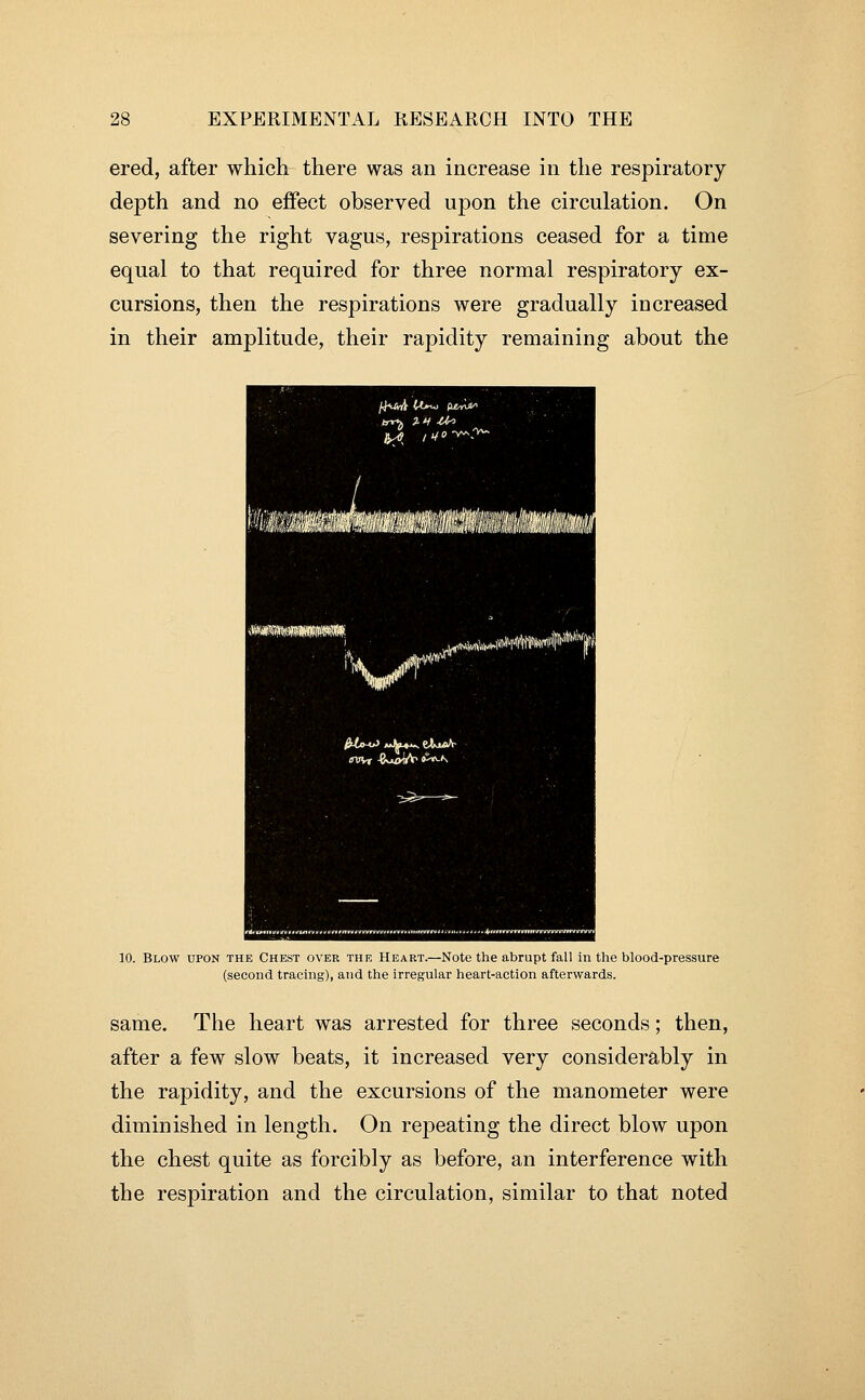 ered, after which there was an increase in the respiratory depth and no effect observed upon the circulation. On severing the right vagus, respirations ceased for a time equal to that required for three normal respiratory ex- cursions, then the respirations were gradually increased in their amplitude, their rapidity remaining about the l4\JrA U»w (U^U^ mBsmi AH'lIiiWiHlilfia mmmmmmiiii ,.vL.iiii*i*W'tomitfr*''''iiti ^lyiWI'l' 1 innn'li''i'i| ff'P '\/^l ^to-iP aJJ«+i«. cImaV 10. Blow upon the Chest over the Heart.—Note the abrupt fall in the blood-pressure (second tracing), and the irregular heart-action afterwards. same. The heart was arrested for three seconds; then, after a few slow beats, it increased very considerably in the rapidity, and the excursions of the manometer were diminished in length. On repeating the direct blow upon the chest quite as forcibly as before, an interference with the respiration and the circulation, similar to that noted