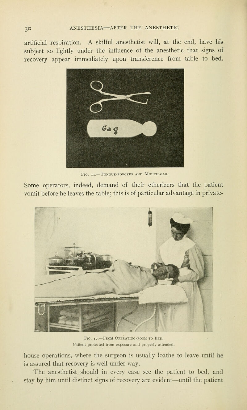 3° artificial respiration. A skilful anesthetist will, at the end, have his subject so lightly under the influence of the anesthetic that signs of recovery appear immediately upon transference from table to bed. Fig. II.—Tongue-forceps and Mouth-gag. Some operators, indeed, demand of their etherizers that the patient vomit before he leaves the table; this is of particular advantage in private- FiG. 12.—From Operating-room to Bed. Patient protected from exposure and properly attended. house operations, where the surgeon is usually loathe to leave until he is assured that recovery is well under way. The anesthetist, should in e^•ery case see the patient to bed, and stay by him until distinct signs of recovery are evident—until the patient