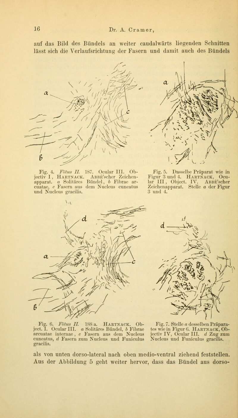auf das Bild des Bündels an weiter caudalwärts liegenden Schnitten lässt sich die Yerlaufsrichtung der Fasern und damit auch des Bündels Fig. 4. Fötus IL 187. Ocular III. Ob- jectiv I, Haktnack. ABBE'scher Zeichen- apparat, a Solitäres Bündel, b Fibrae ar- cuatae, c Fasern aus dem Nucleus cuneatus und Nucleus gracilis. Fig. 5. Dasselbe Präparat wie in Figur 3 und 4. Haetxack, Ocu- lar III, Object. IV. ABBE'scher Zeicbenapparat. Stelle a der Figur 3 und 4. Fig. 6. Fötus IL 188 a. Hartnack. Ob- Fig. 7. Stelle a desselben Präpara- ject. I. Ocular III. a Solitäres Bündel, b Fibrae tes wie in Figur G. Hartnack, Ob- arcuatae internae , c Fasern aus dem Nucleus jectiv IV, Ocular III. d Zug zum cuneatus, d Fasern zum Nucleus und Funiculus Nucleus imd Funiculus gracUis. gracüis. als von unten dorso-lateral nach oben medio-ventral ziehend feststellen. Aus der Abbildung 5 geht weiter hervor, dass das Bündel aus dorso-