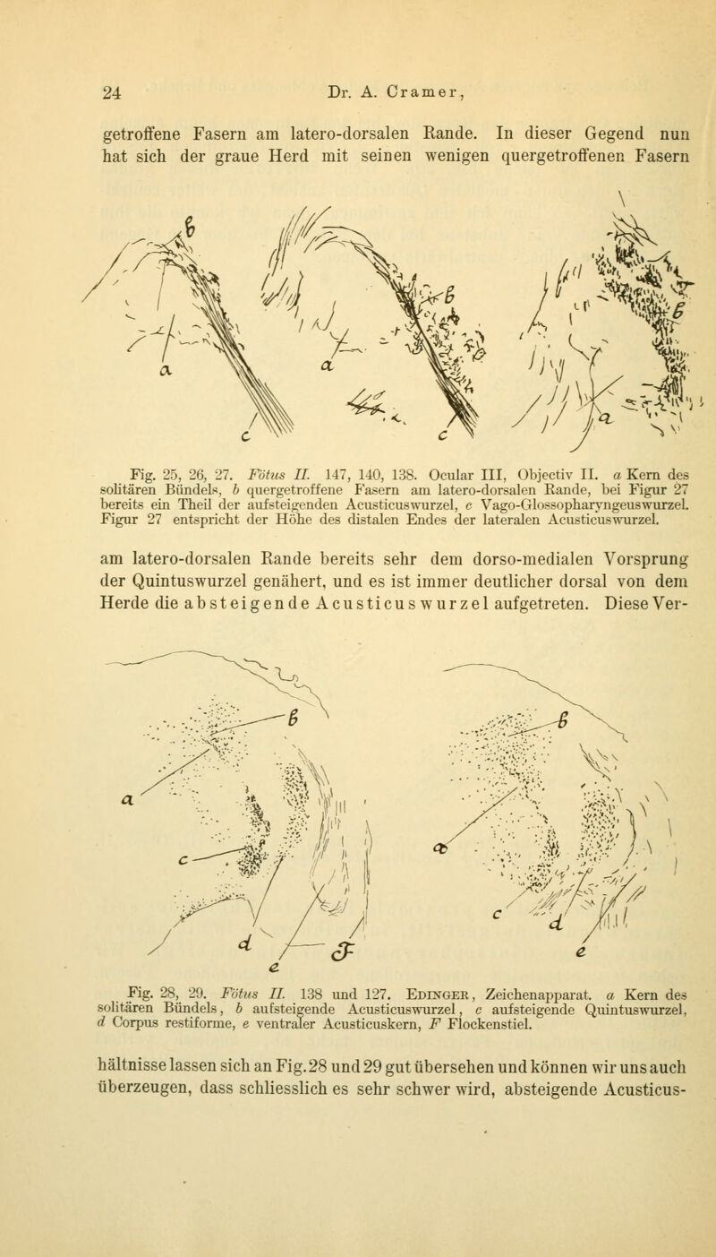 getroffene Fasern am latero-dorsalen Rande. In dieser Gegend nun hat sich der graue Herd mit seinen wenigen quergetroffenen Fasern \ t Fig. 25, 26, 27. Föhis U. 147, 140, 138. Ocular III, Objectiv II. a Kern des soHtären Bündels, b quergetroffene P'asem am latero-dorsalen Kande, bei Figur 27 bereits ein Tbeil der aiifsteigenden Acusticuswurzel, c Vago-GlossopharyngeuswurzeL Figur 27 entspricht der Höhe des distalen Endes der lateralen Acusticuswurzel. am latero-dorsalen Rande bereits sehr dem dorso-medialen Vorsprung der Quintuswurzel genähert, und es ist immer deutlicher dorsal von dem Herde dieabsteigendeAcusticuswurzel aufgetreten. Diese Ver- Fig. 28, 29. Fötus IL 138 und 127. Edinger, Zeichenapparat, a Kern des soütären Bündels, b aufsteigende Acusticuswurzel, c aufsteigende Quintus^vurzel, d Corpus restiforme, e ventraler Acusticuskern, F Flockenstiel. hältnisse lassen sich an Fig. 28 und 29 gut übersehen und können wir uns auch überzeugen, dass schliesslich es sehr schwer wird, absteigende Acusticus-