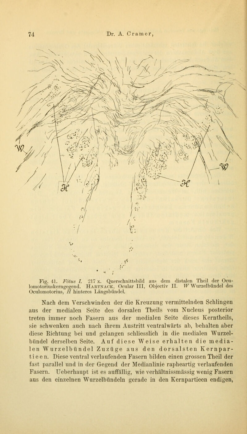 Fig. 41. Fötus I. 217 x. Quersclmittsbild aus dem distalen Tlieil der Ocu- lomotoriuskerngegend. Hartnack, Ocular III, Objectiv II. TT Wurzelbündel des Oculomotorius, H hinteres Längsbündel. Nach dem Verschwinden der die Kreuzung vermittelnden Schlingen aus der medialen Seite des dorsalen Theils vom Nucleus posterior treten immer noch Fasern aus der medialen Seite dieses Kerntheils, sie schwenken auch nach ihrem Austritt ventralwärts ab, behalten aber diese Richtung bei und gelangen schliesslich in die medialen Wurzel- bündel derselben Seite. Auf diese Weise erhalten die media- len Wurzelbündel Zuzüge aus den dorsalsten Kernpar- tie e n. Diese ventral verlaufenden Fasern bilden einen grossen Theil der fast parallel und in der Gegend der Medianlinie rapheartig verlaufenden Fasern. Ueberhaupt ist es aulfällig, wie verhältnissmässig wenig Fasern aus den einzelnen Wurzelbündeln gerade in den Kernpartieen endigen,