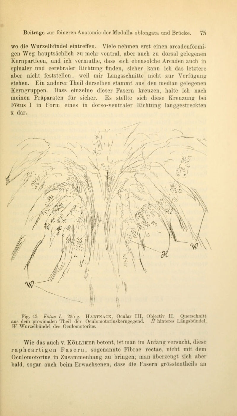 WO die Wurzelbündel eintreffen. Viele nehmen erst einen arcadenförmi- gen Weg hauptsächlich zu mehr ventral, aber auch zu dorsal gelegenen Kernpartieen, und ich vermuthe, dass sich ebensolche Arcaden auch in spinaler und cerebraler Richtung finden, sicher kann ich das letztere aber nicht feststellen, weil mir Längsschnitte nicht zur Verfügung stehen. Ein anderer Theil derselben stammt aus den median gelegenen Kerngruppen. Dass einzelne dieser Fasern kreuzen, halte ich nach meinen Präparaten für sicher. Es stellte sich diese Kreuzung bei Fötus I in Form eines in dorso-ventraler Richtung langgestreckten X dar. Fig. 42. Fötus I. 235 g. Hartxack, Ocular III, (^bjectiv II. Querschnitt aus dem proximalen Theil der Oculomotoriuskerngegend. // hinteres Längsbündel, W Wurzelbündel des Oculomotorius. Wie das auch v. Kölliker betont, ist man im Anfang versucht, diese rapheartigen Fasern, sogenannte Fibrae rectae, nicht mit dem Oculomotorius in Zusammenhang zu bringen; man überzeugt sich aber bald, sogar auch beim Erwachsenen, dass die Fasern grösstentheils an