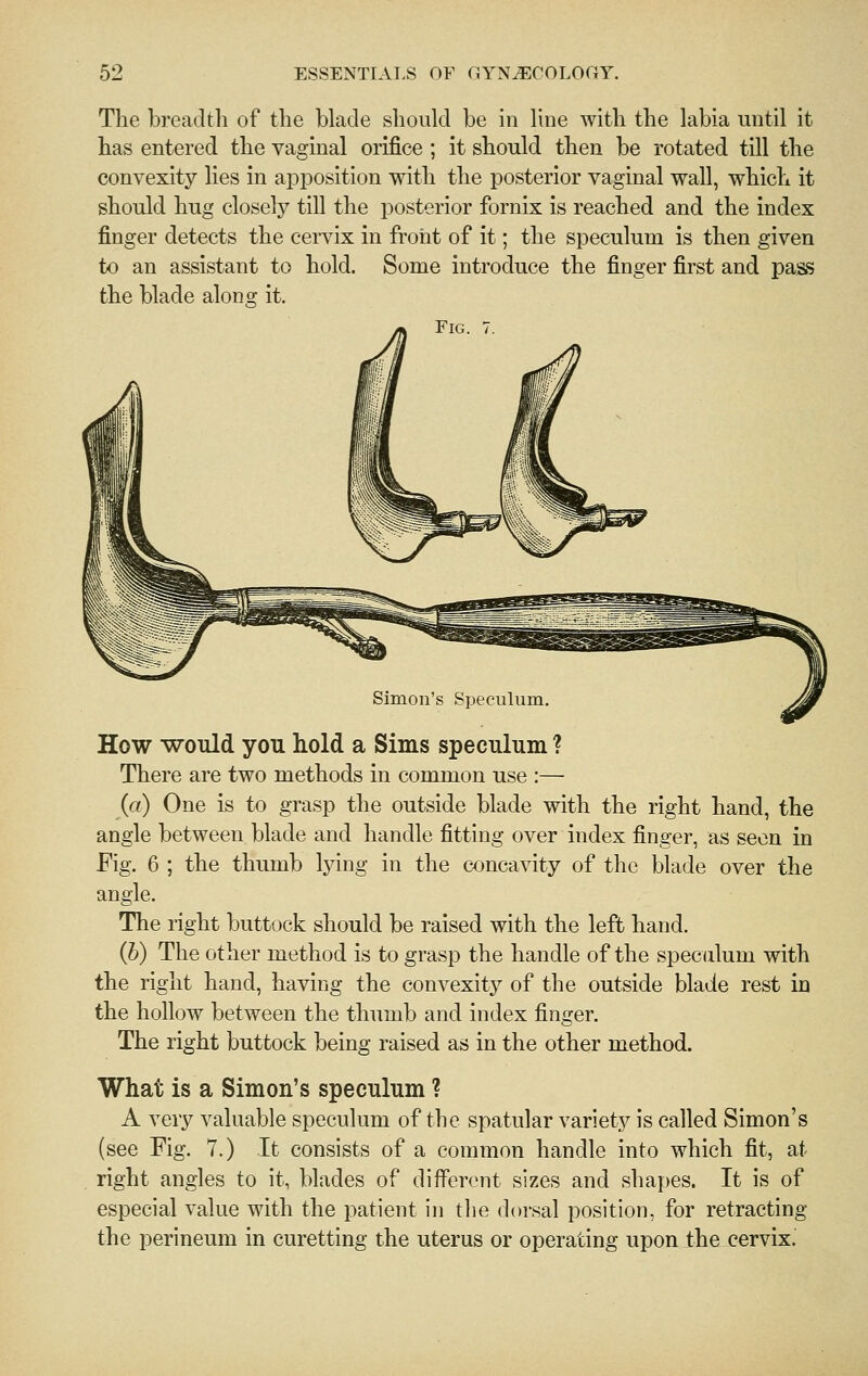 The breadth of the blade should be in Hne with the labia until it has entered the vaginal orifice ; it should then be rotated till the convexity lies in apposition with the posterior vaginal wall, which it should hug closely till the posterior fornix is reached and the index finger detects the cervix in froiit of it; the speculum is then given to an assistant to hold. Some introduce the finger first and pass the blade along it. Fig. 7. Simon's Speculum. How would you hold a Sims speculum ? There are two methods in common use :— (rt) One is to grasp the outside blade with the right hand, the angle between blade and handle fitting over index finger, as seen in Fig. 6 ; the thumb lying in the concavity of the blade over the angle. The right buttock should be raised with the left hand. (6) The other method is to grasp the handle of the speculum with the right hand, having the convexity of the outside blade rest in the hollow between the thumb and index finger. The right buttock being raised as in the other method. What is a Simon's speculum ? A very valuable speculum of the spatular variety is called Simon's (see Fig. 7.) It consists of a common handle into which fit, at right angles to it, blades of different sizes and sha})es. It is of especial value with the patient in tlie dorsal position, for retracting the perineum in curetting the uterus or operating upon the cervix.