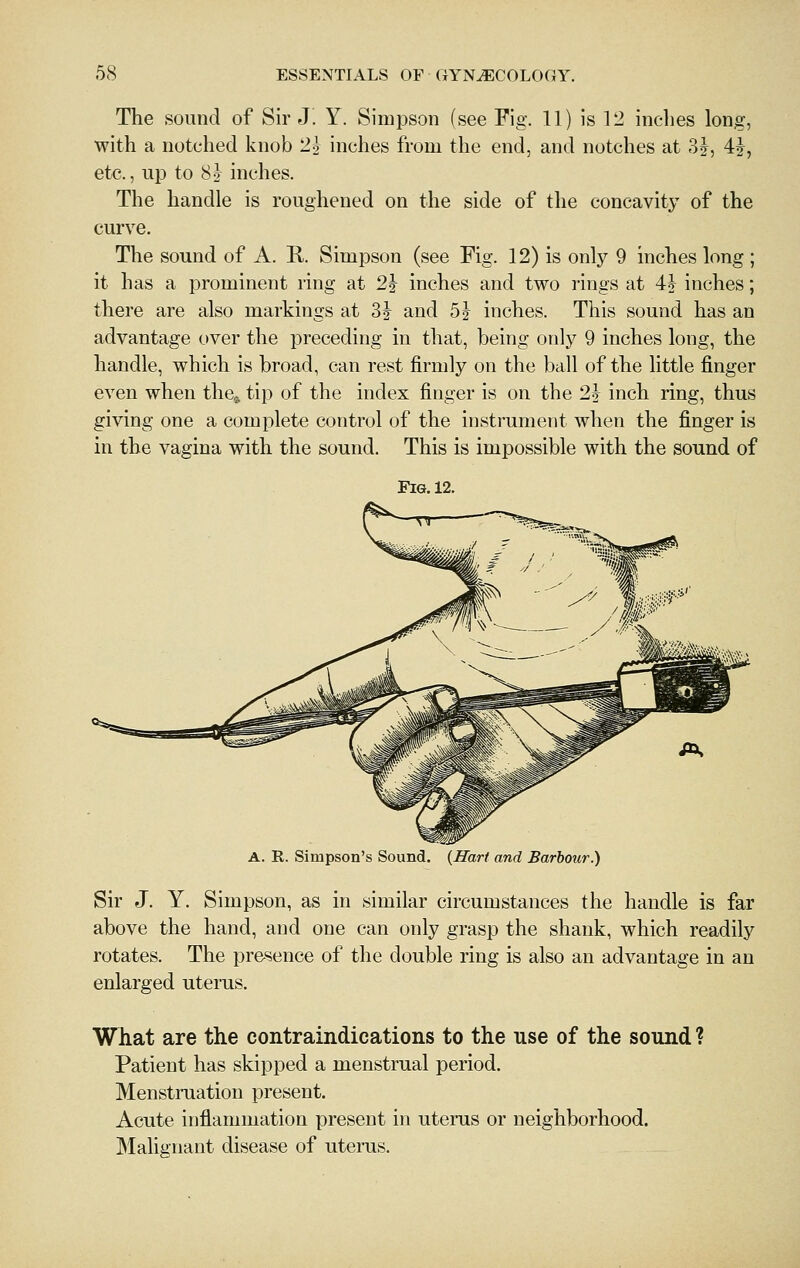 The sound of Sir J. Y. Simpson (see Fig. 11) is 12 inches long, with a notched knob 2j inches from the end, and notches at 3J, 4^, etc., up to 82^ inches. The handle is roughened on the side of the concavity of the curve. The sound of A. R. Simpson (see Fig. 12) is only 9 inches long ; it has a prominent ring at 2} inches and two rings at 4J inches; there are also markings at 3J and 5 J inches. This sound has an advantage over the preceding in that, being only 9 inches long, the handle, which is broad, can rest firmly on the ball of the little finger even when the^, tip of the index finger is on the 2J inch ring, thus giving one a complete control of the instrument when the finger is in the vagina with the sound. This is impossible with the sound of Fig. 12. A. R. Simpson's Sound. {Jlart and Barbour.) Sir J. Y. Simpson, as in similar circumstances the handle is far above the hand, and one can only grasp the shank, which readily rotates. The pre-sence of the double ring is also an advantage in an enlarged uterus. What are the contraindications to the use of the sound ? Patient has skipped a menstrual period. Menstruation present. Acute inflammation present in uterus or neighborhood. Malignant disease of utei-us.