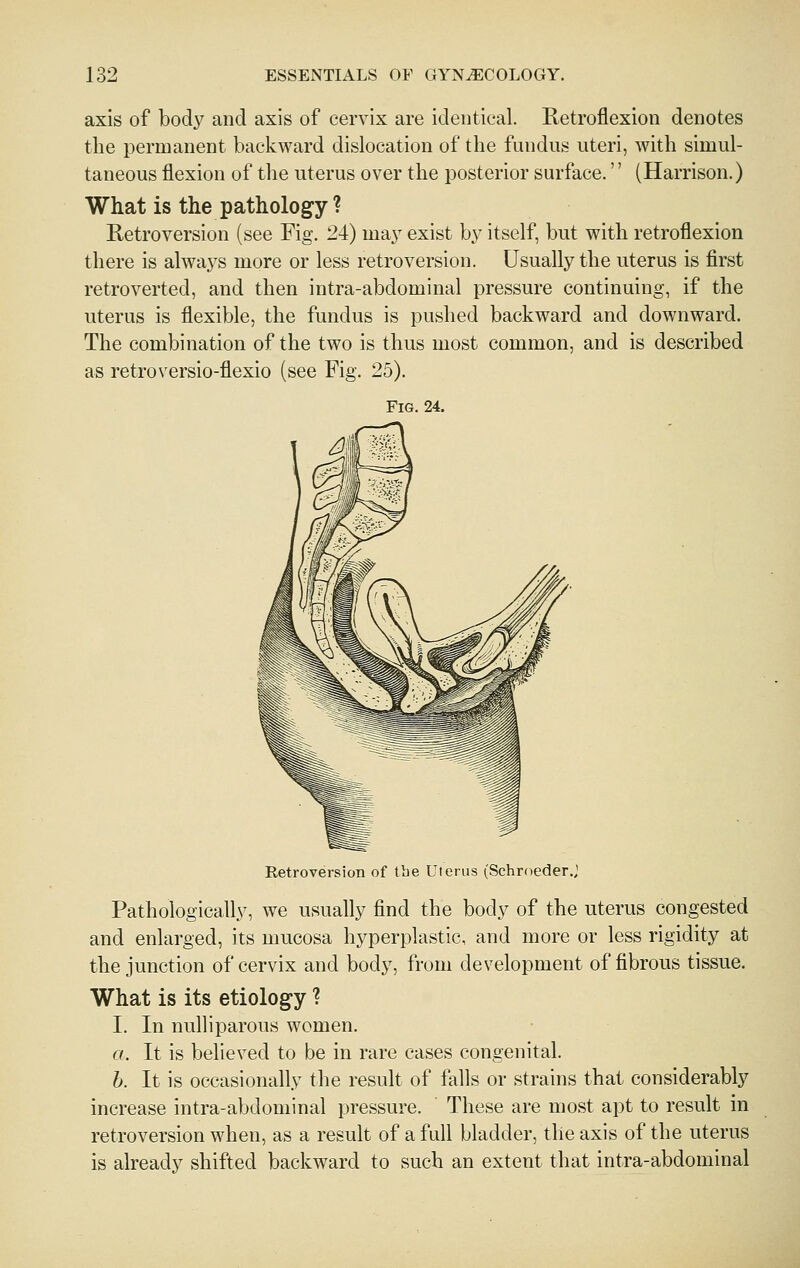 axis of bodj^ and axis of cervix are identical. Retroflexion denotes the permanent backward dislocation of the fundus uteri, with simul- taneous flexion of the uterus over the posterior surface.'' (Harrison.) What is the pathology ? Retroversion (see Fig. 24) ma} exist by itself, but with retroflexion there is alwa3^s more or less retroversion. Usually the uterus is first retroverted, and then intra-abdominal pressure continuing, if the uterus is flexible, the fundus is pushed backward and downward. The combination of the two is thus most common, and is described as retroversio-flexio (see Fig. 25). Fig. 24. Retroversion of the Uterus (Schroeder.J Pathologically, we usually find the body of the uterus congested and enlarged, its mucosa hyperplastic, and more or less rigidity at the junction of cervix and body, from development of fibrous tissue. What is its etiolog-y ? I. In nulliparous women. a. It is believed to be in rare cases congenital. h. It is occasionally the result of falls or strains that considerably increase intra-abdominal pressure. These are most apt to result in retroversion when, as a result of a full bladder, the axis of the uterus is already shifted backward to such an extent that intra-abdominal
