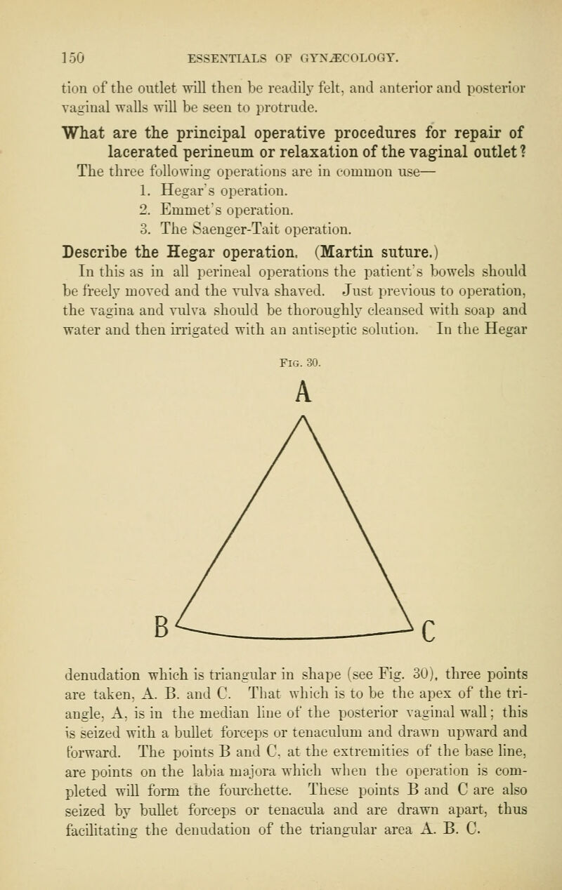 tion of the outlet will then be readil}- felt, and anterior and posterior vaginal walls will be seen to protrude. What are the principal operative procedures for repair of lacerated perineum or relaxation of the vaginal outlet ? The three following operations are in common use— 1. Hegars operation. 2. Emmet's operation. 3. The Saenger-Tait operation. Describe the Hegar operation. (Martin suture.) In this as in all perineal operations the patients bowels should be freelj' moved and the vulva shaved. Just previous to operation, the vagina and vulva should be thoroughly cleansed with soap and water and then irrigated with an antiseptic solution. In the Hegar Fig. 30. A denudation which is triangular in shape (see Fig. 30), three points are taken, A. B. and C. That which is to be the apex of the tri- angle, A, is in the median line of the posterior vaginal wall; this is seized with a bullet forceps or tenaculum and drawn upward and forward. The points B and C. at the extremities of the base line, are points on the labia majora which when the opei-ation is com- pleted win form the fourchette. These points B and C are also seized by bullet forceps or tenacula and are drawn apart, thus facilitating the denudation of the triangular area A. B. C.