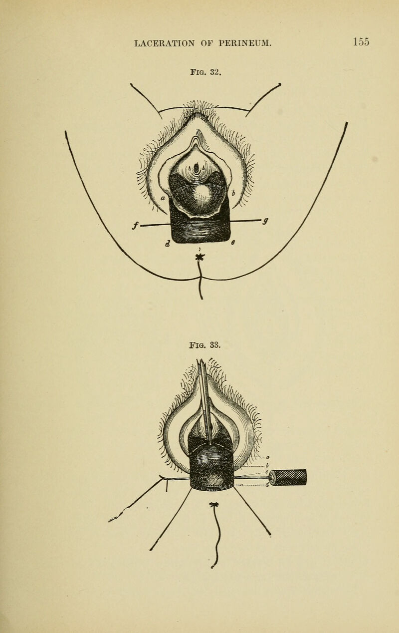 Fig. 32. na. 33,
