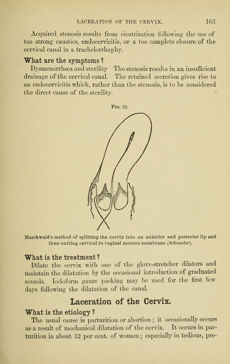 Acquired stenosis results from cicatrization following the use of too strong caustics, endocervicitis, or a too complete closure of tlie cervical canal in a trachelorrhaphy. What are the symptoms ? D^^smenorrhoea and sterility The stenosis results in an insufficient drainage of the cervical canal. The retained secretion gives rise to an endocervicitis which, rather than the stenosis, is to be considered the direct cause of the sterility. Fig. 39. Marckwald's method of splitting the cervix into an anterior and posterior lip and then uniting cervical to vaginal mucous membrane {Schroeder). What is the treatment ? Dilate the ceiTix with one of the glove-stretcher dilators and maintain the dilatation by the occasional introduction of graduated sounds. Iodoform gauze packing may be used for the first few days following the dilatation of the canal. Laceration of the Cervix. What is the etiology ? The usual cause is parturition or abortion ; it occasionally occurs as a result of mechanical dilatation of the cervix. It occurs in par- turition in about 32 per cent, of women ; especially in tedious, pre-