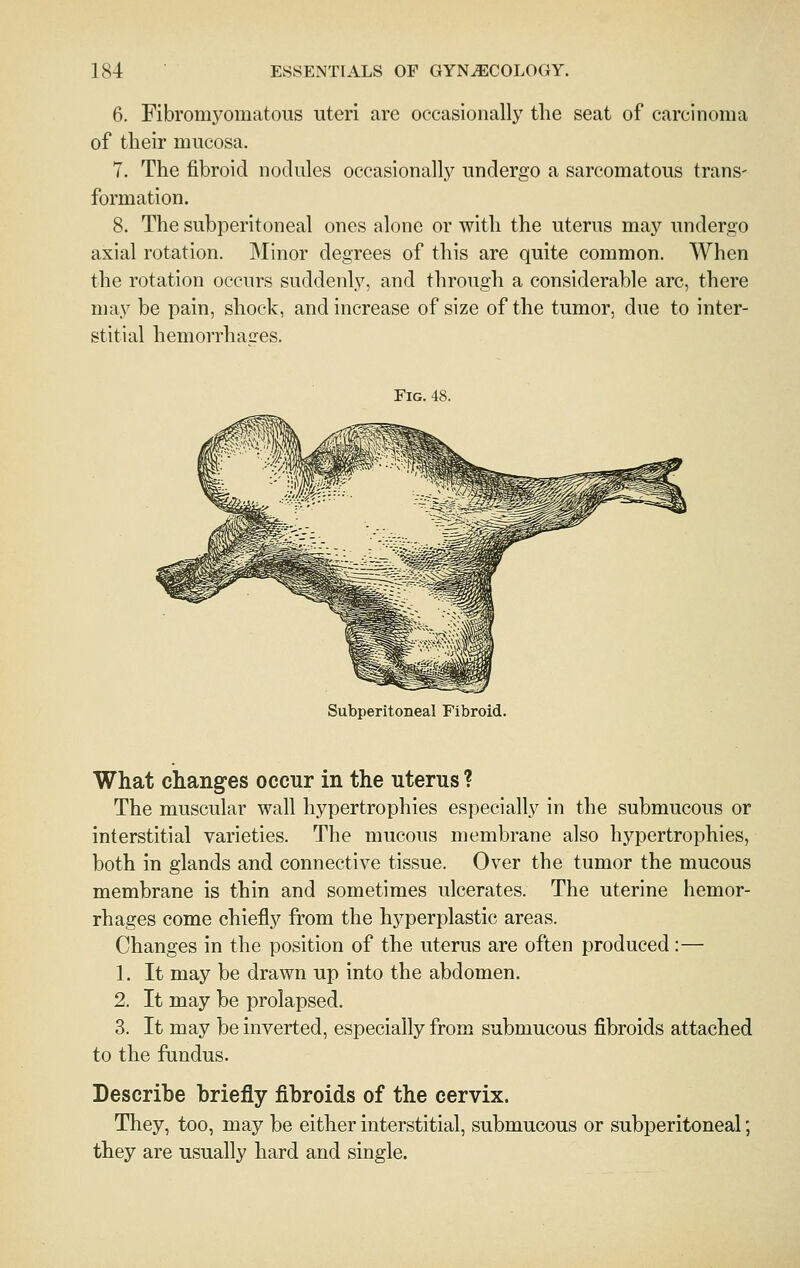 6. Fibromyomatous uteri are occasionally the seat of carcinoma of their mucosa. 7. The fibroid nodules occasionally undergo a sarcomatous trans- formation. 8. The subperitoneal ones alone or with the uterus may undergo axial rotation. Minor degrees of this are quite common. When the rotation occurs suddenly, and through a considerable arc, there may be pain, shock, and increase of size of the tumor, due to inter- stitial hemorrhasres. Fig. Subperitoneal Fibroid. What changes occur in the uterus ? The muscular wall hypertrophies especially in the submucous or interstitial varieties. The mucous membrane also hypertrophies, both in glands and connective tissue. Over the tumor the mucous membrane is thin and sometimes ulcerates. The uterine hemor- rhages come chiefly from the hyperplastic areas. Changes in the position of the uterus are often produced:— 1. It may be drawn up into the abdomen. 2. It may be prolapsed. 3. It may be inverted, especially from submucous fibroids attached to the fundus. Describe briefly fibroids of the cervix. They, too, may be either interstitial, submucous or subperitoneal; they are usually hard and single.