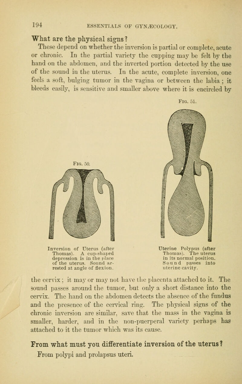 What are the physical signs ? These depend on whether the inversion is partial or complete, acute or chronic. In the partial variety the cupping may be felt by the hand on the abdomen, and the inverted portion detected by the use of the sound in the utenis. In the acute, complete inversion, one feels a soft, bulging tumor in the vagina or between the labia ; it bleeds easily, is sensitive and smaller above where it is encircled by Fig. 51. Fig. 50. Inversion of Uterus (after Thomas). A cup-shaped depression is in the r'lace of the uterus. Sound ar- rested at angle of flexion. Uterine Polypus (after Thomas). The uterus in its normal position. Sound passes into uterine cavity. the cervix; it may or may not have the placenta attached to it. The sound passes around the tumor, but only a short distance into the cei-vix. Tlie hand on the abdomen detects the absence of the fundus and the presence of the cemcal ring. The physical signs of the chronic inversion are similar, save that the mass in the vagina is smaller, harder, and in the non-puerperal variety perhaps has attached to it the tumor which was its cause. From what must you differentiate inversion of the uterus ? From polypi and prolapsus uteri.