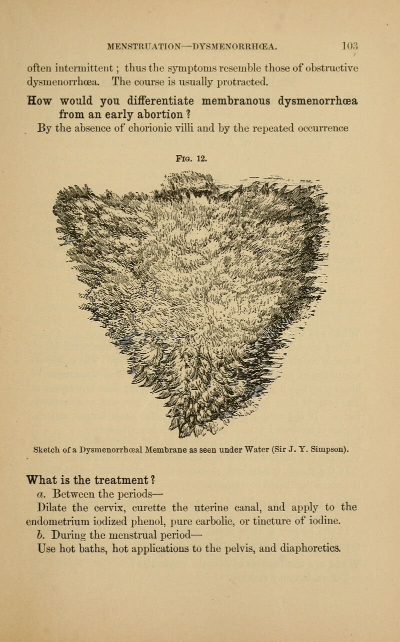 often intermittent; thus the symptoms resemble those of obstructive dysinenorrhoea. The course is usually protracted. How would you differentiate membranous dysmenorrhea from an early abortion ? By the absence of chorionic villi and by the repeated occurrence Fig. 12. Sketch of a Dysmenorrhceal Membrane as seen under Water (Sir J. Y. Simpson). What is the treatment ? a. Between the periods— Dilate the cervix, curette the uterine canal, and apply to the endometrium iodized phenol, pure carbolic, or tincture of iodine. I). During the menstrual period— Use hot baths, hot applications to the pelvis, and diaphoretics.