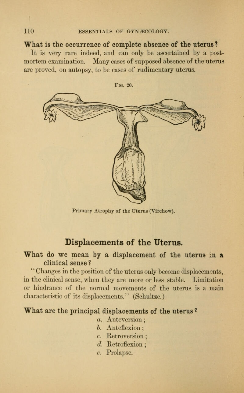 What is the occurrence of complete absence of the uterus? It is very rare indeed, and can only be ascertained by a post- mortem examination. Many cases of supposed absence of the uterus are proved, on autopsy, to be cases of rudimentary uterus. Fig. 20. Primary Atrophy of the Uterus (Virchow). Displacements of the Uterus. What do we mean by a displacement of the uterus in a clinical sense ? Changes in the position of the uterus only become displacements, in the clinical sense, when they are more or less stable. Limitation or hindrance of the normal movements of the uterus is a main characteristic of its displacements.'' (Schultzc.) What are the principal displacements of the uterus 1 a. Anteversion ; b. Anteflexion; c. Retroversion ; d. Retroflexion ; e. Prolapse.