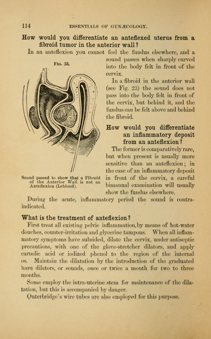 Fig. 23. How would you differentiate an anteflexed uterus from a fibroid tumor in the anterior wall ? In an anteflexion you cannot feel the fundus elsewhere, and a sound passes when sharply curved into the body felt in front of the cervix. In a fibroid in the anterior wall (see Fig. 23) the sound does not pass into the body felt in front of the cervix, but behind it, and the fundus can be felt above and behind the fibroid. Sound passed to show that a Fibroid of the Anterior Wall is not an Anteflexion (Leblond). How would you differentiate an inflammatory deposit from an anteflexion ? The former is comparatively rare, but when present is usually more sensitive than an anteflexion; in the case of an inflammatory deposit in front of the cervix, a careful bimanual examination will usually show the fundus elsewhere. During the acute, inflammatory period the sound is contra- indicated. What is the treatment of anteflexion ? First treat all existing pelvic inflammation.by means of hot-water douches, counter-irritation and glycerine tampons. When all inflam- matory symptoms have subsided, dilate the cervix, under antiseptic precautions, with one of the glove-stretcher dilators, and apply caroolic acid or iodized phenol to the region of the internal os. Maintain the dilatation by the introduction of the graduated ham dilators, or sounds, once or twice a month for two to three months. Some employ the intra-uterine stem for maintenance of the dila- tation, but this is accompanied by danger. Quterbridge's wire tubes are also <inployed for this purpose.