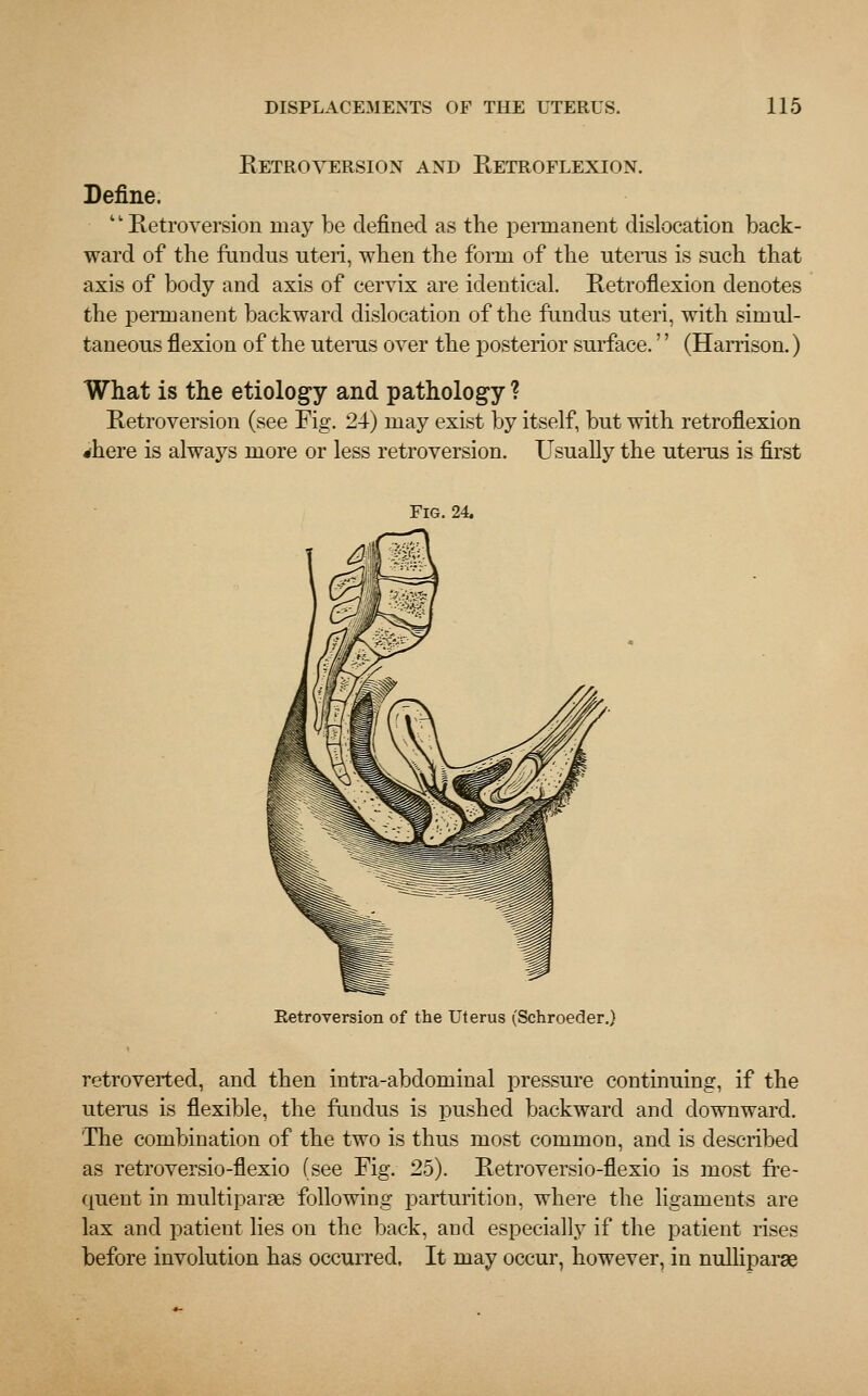 Retroversion and Retroflexion. Define. Retroversion may be defined as the permanent dislocation back- ward of the fundus uteri, when the form of the uterus is such that axis of body and axis of cervix are identical. Retroflexion denotes the permanent backward dislocation of the fundus uteri, with simul- taneous flexion of the uterus over the posterior surface.'' (Harrison.) What is the etiology and pathology ? Retroversion (see Fig. 24) may exist by itself, but with retroflexion •here is always more or less retroversion. Usually the uterus is first Fig. 24. Retroversion of the Uterus (Schroeder.) retroverted, and then intra-abdominal pressure continuing, if the uterus is flexible, the fundus is pushed backward and downward. The combination of the two is thus most common, and is described as retroversio-flexio (see Fig. 25). Retroversio-flexio is most fre- quent in multiparas following parturition, where the ligaments are lax and patient lies on the back, and especially if the patient rises before involution has occurred. It may occur, however, in nulliparae