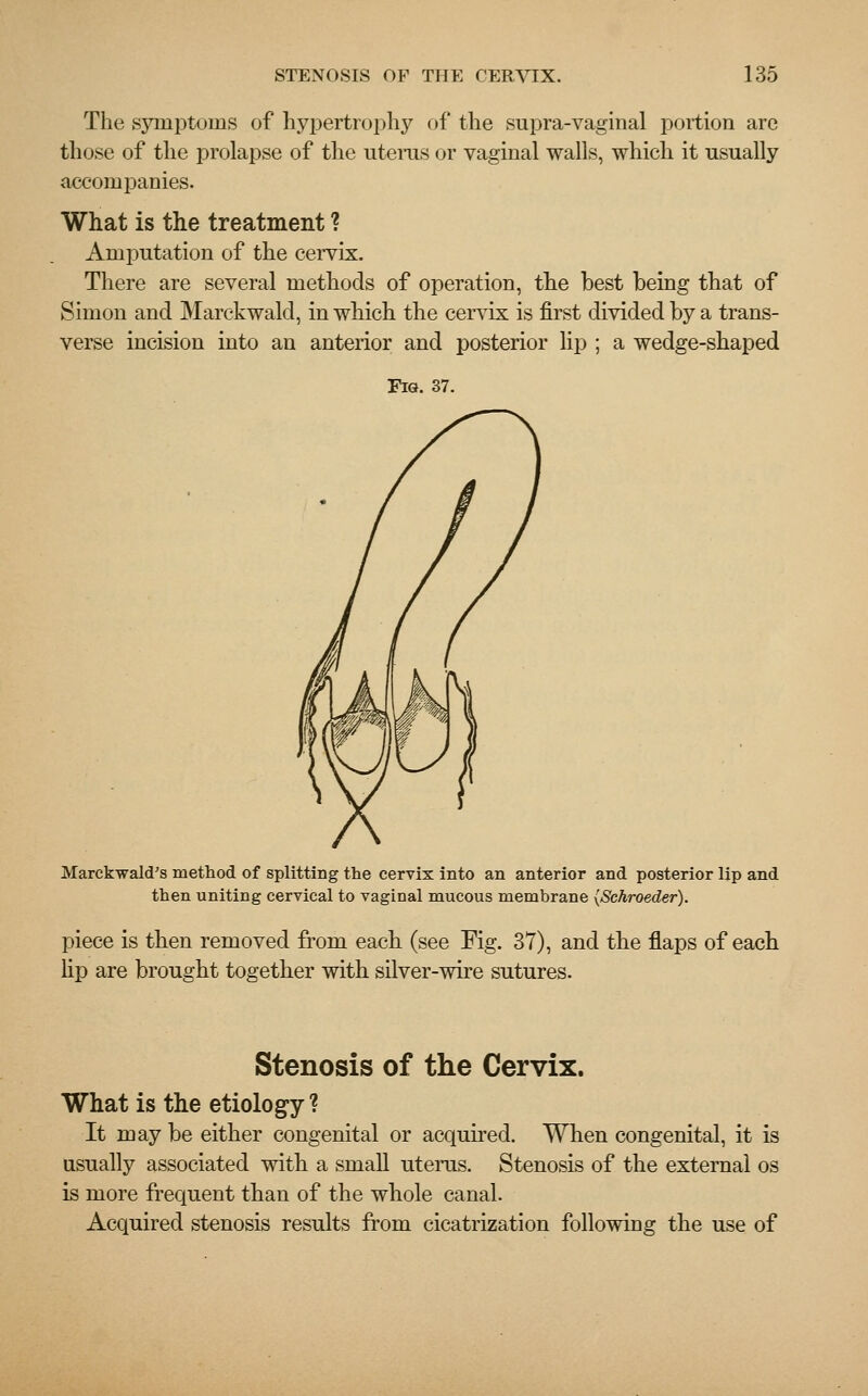 The symptoms of hypertrophy of the supra-vaginal portion are those of the prolapse of the uterus or vaginal walls, which it usually accompanies. What is the treatment ? Amputation of the cervix. There are several methods of operation, the best being that of Simon and Marckwald, in which the cervix is first divided by a trans- verse incision into an anterior and posterior lip ; a wedge-shaped Fig. 37. Marckwald's method of splitting the cervix into an anterior and posterior lip and then uniting cervical to vaginal mucous membrane {Schroeder). piece is then removed from each (see Fig. 37), and the flaps of each lip are brought together with silver-wire sutures. Stenosis of the Cervix. What is the etiology ? It may be either congenital or acquired. When congenital, it is usually associated with a small uterus. Stenosis of the external os is more frequent than of the whole canal. Acquired stenosis results from cicatrization following the use of