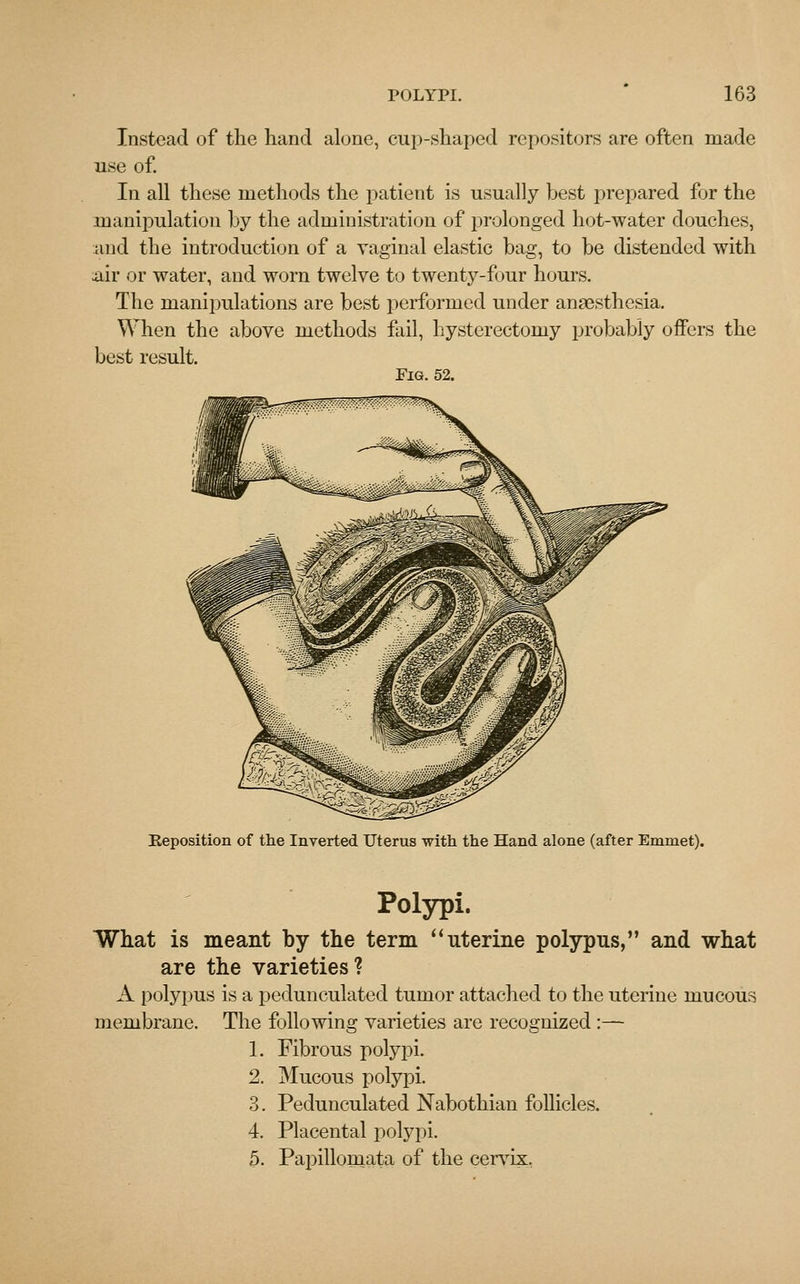 Instead of the hand alone, cup-shaped repositors are often made use of. In all these methods the patient is usually best prepared for the manipulation by the administration of prolonged hot-water douches, and the introduction of a vaginal elastic bag, to be distended with air or water, and worn twelve to twenty-four hours. The manipulations are best performed under anaesthesia. When the above methods fail, hysterectomy probably offers the best result. Fig. 52. Reposition of the Inverted Uterus with the Hand alone (after Emmet). Polypi. What is meant by the term uterine polypus, and what are the varieties? A polypus is a pedunculated tumor attached to the uterine mucous membrane. The following varieties are recognized :— 1. Fibrous polypi. 2. Mucous polypi. 3. Pedunculated Nabothian follicles. 4. Placental polypi. 5. Papillomata of the cervix,