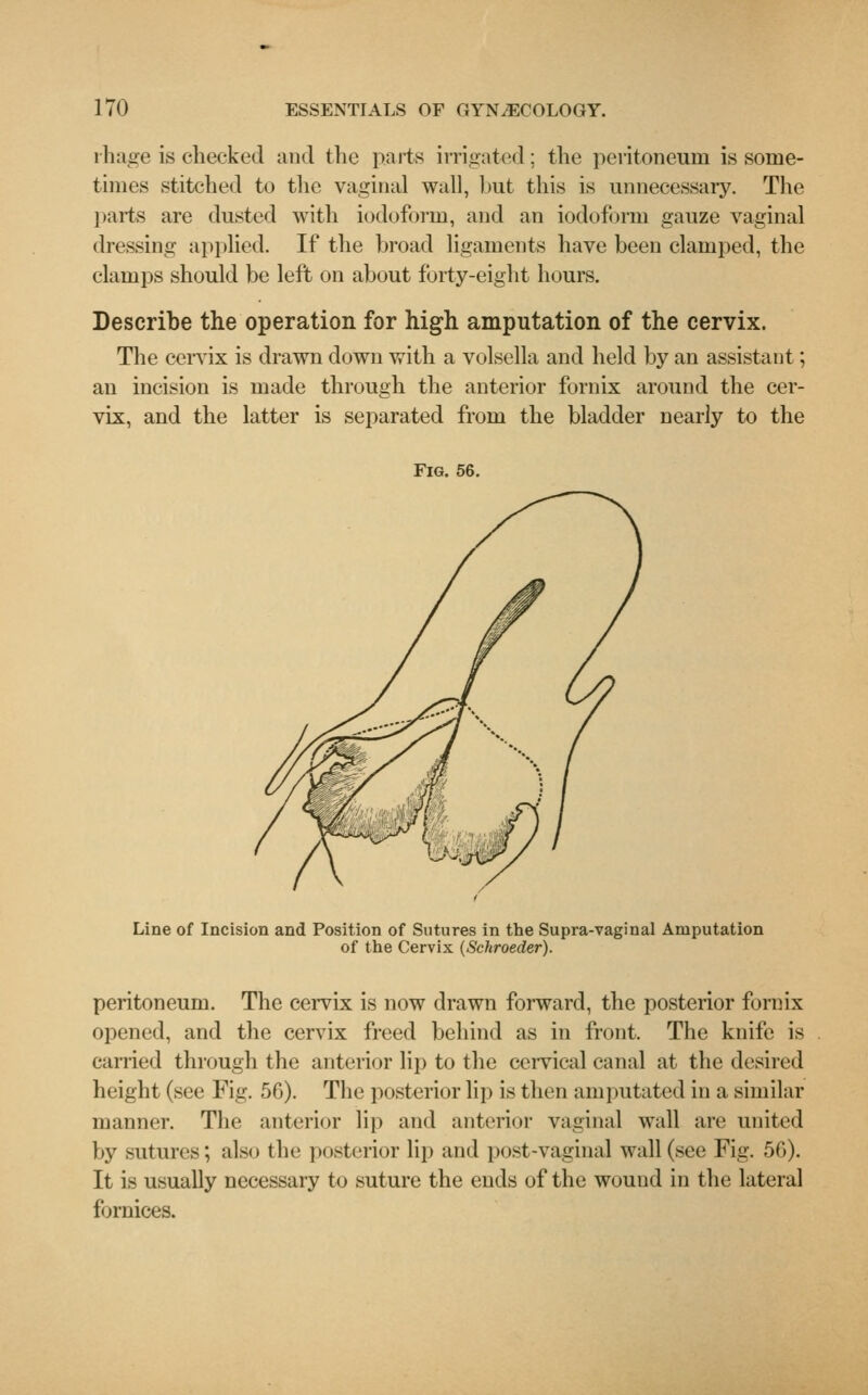 rhage is checked and the parts irrigated: the peritoneum is some- times stitched to the vaginal wall, but this is unnecessary. The parts are dusted with iodoform, and an iodoform gauze vaginal dressing applied. If the broad ligaments have been clamped, the clamps should be left on about forty-eight hours. Describe the operation for high amputation of the cervix. The cervix is drawn down with a volsella and held by an assistant; an incision is made through the anterior fornix around the cer- vix, and the latter is separated from the bladder nearly to the Fig. 56. Line of Incision and Position of Sutures in the Supra-vaginal Amputation of the Cervix (Schroeder). peritoneum. The cervix is now drawn forward, the posterior fornix opened, and the cervix freed behind as in front. The knife is carried through the anterior lip to the cervical canal at the desired height (see Fig. 56). The posterior lip is then amputated in a similar manner. The anterior lip and anterior vaginal wall are united by sutures; also the posterior lip and post-vaginal wall (see Fig. 5G). It is usually necessary to suture the ends of the wound in the lateral fornices.