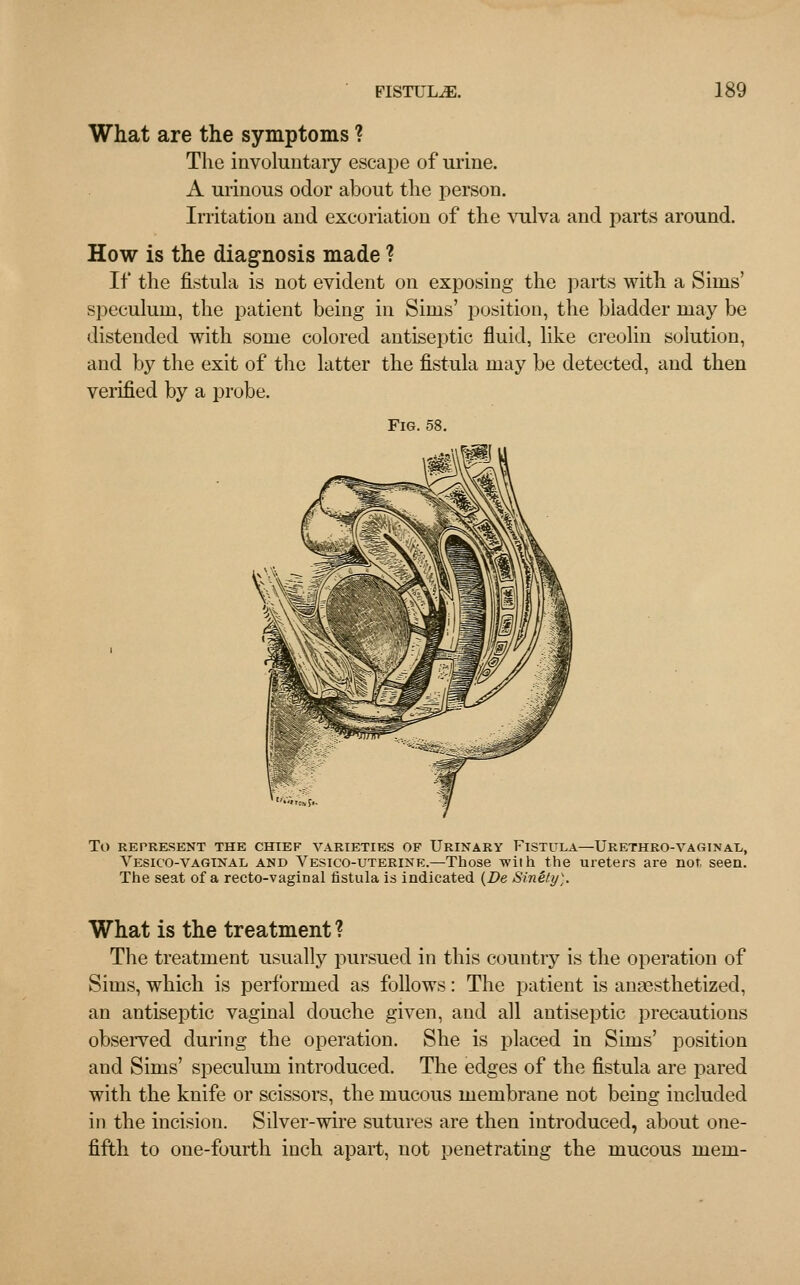 What are the symptoms ? The involuntary escape of urine. A urinous odor about the person. Irritation and excoriation of the vulva and parts around. How is the diagnosis made ? If the fistula is not evident on exposing the parts with a Sims' speculum, the patient being in Sims' position, the bladder may be distended with some colored antiseptic fluid, like creolin solution, and by the exit of the latter the fistula may be detected, and then verified by a probe. Fig. 58. TO REPRESENT THE CHIEF VARIETIES OF URINARY FISTULA—URETHRO-VAGINAD, Vesico-vaginal and Vesico-uterine.—Those with the ureters are not, seen. The seat of a recto-vaginal fistula is indicated (De Sinety). What is the treatment ? The treatment usually pursued in this country is the operation of Sims, which is performed as follows: The patient is anaesthetized, an antiseptic vaginal douche given, and all antiseptic precautions observed during the operation. She is placed in Sims' position and Sims' speculum introduced. The edges of the fistula are pared with the knife or scissors, the mucous membrane not being included in the incision. Silver-wire sutures are then introduced, about one- fifth to one-fourth inch apart, not penetrating the mucous mem-