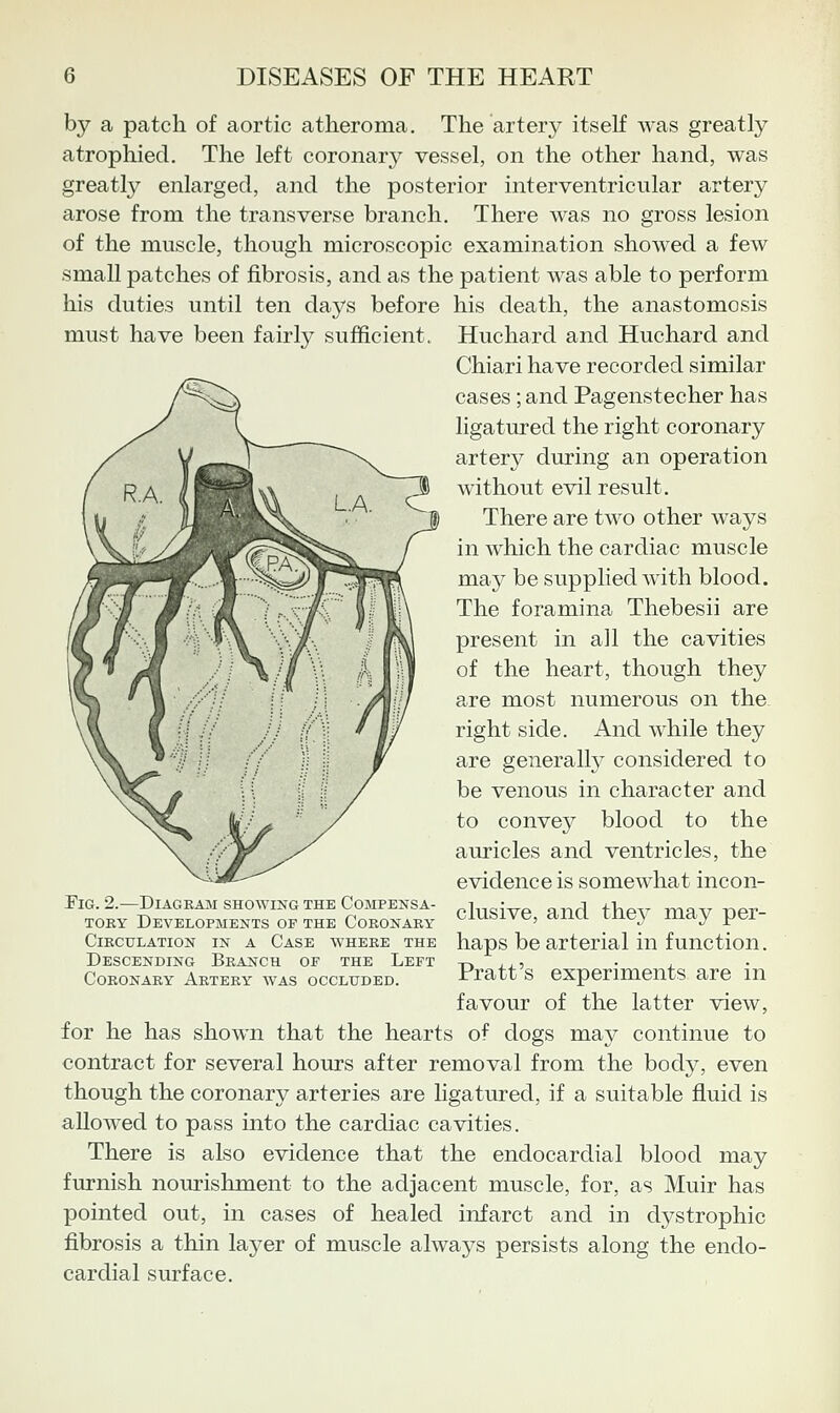 by a patch of aortic atheroma. The artery itself was greatly atrophied. The left coronary vessel, on the other hand, was greatly enlarged, and the posterior interventricular artery arose from the transverse branch. There was no gross lesion of the muscle, though microscopic examination showed a few small patches of fibrosis, and as the patient was able to perform his duties until ten days before his death, the anastomosis must have been fairly sufficient. Huchard and Huchard and Chiari have recorded similar cases; and Pagenstecher has ligatured the right coronary artery during an operation without evil result. There are two other ways in which the cardiac muscle may be supplied with blood. The foramina Thebesii are present in all the cavities of the heart, though they are most numerous on the right side. And while they are generally considered to be venous in character and to convey blood to the auricles and ventricles, the evidence is somewhat incon- TiG. 2.—Diagram SHOWING THE CoMPENSA- pi,,„,Vp „.-,.] ^-v,p,, mav r^pr- TORY Developments of the Coronary cmsive, anci tne}' may per Circulation in a Case where the haps be arterial in function. Descending Branch of the Left p xj.5 , • j. , Coronary Artery was occluded. Jrratt S experiments are m favour of the latter view, for he has shown that the hearts of dogs may continue to contract for several hours after removal from the body, even though the coronary arteries are ligatured, if a suitable fluid is allowed to pass into the cardiac cavities. There is also evidence that the endocardial blood may furnish nourishment to the adjacent muscle, for, as Muir has pointed out, in cases of healed infarct and in dystrophic fibrosis a thin layer of muscle always persists along the endo- cardial surface.
