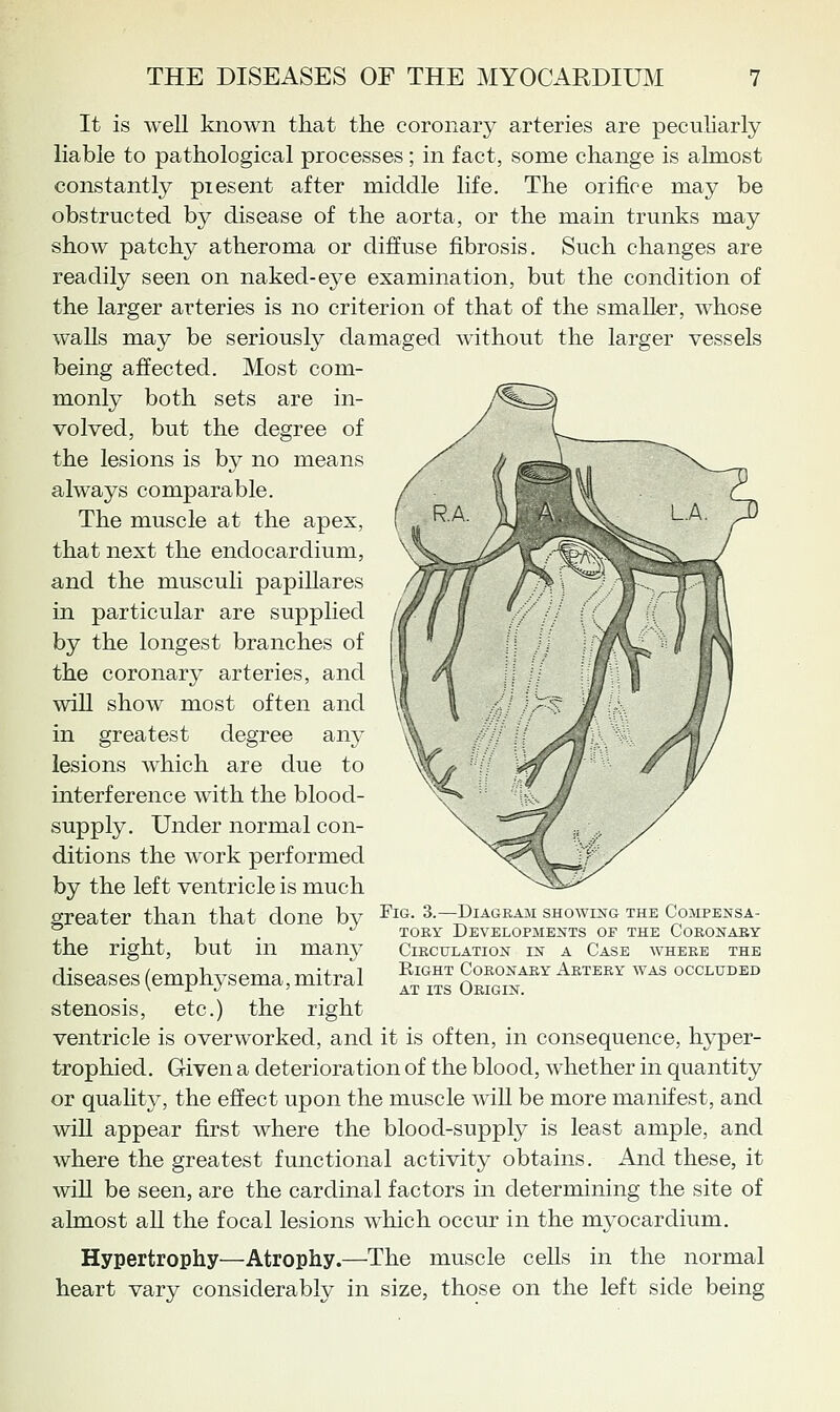It is weU known that the coronary arteries are pecuKarly liable to pathological processes; in fact, some change is almost constantly piesent after middle life. The orifice may be obstructed by disease of the aorta, or the main trunks may show patchy atheroma or diffuse fibrosis. Such changes are readily seen on naked-eye examination, but the condition of the larger arteries is no criterion of that of the smaller, whose walls may be seriously damaged without the larger vessels being affected. Most com- monly both sets are in- volved, but the degree of the lesions is by no means always comparable. The muscle at the apes, that next the endocardium, and the musculi papillares in particular are supplied by the longest branches of the coronary arteries, and will show most often and in greatest degree any lesions Avhich are due to interference with the blood- supply. Under normal con- ditions the work performed by the left ventricle is much greater than that done by the right, but in many diseases (emphysema, mitral stenosis, etc.) the right ventricle is overworked, and it is often, in consequence, hyper- trophied. Given a deterioration of the blood, whether in quantity or quahty, the effect upon the muscle will be more manifest, and wiU appear first where the blood-supply is least ample, and where the greatest functional activity obtains. And these, it will be seen, are the cardinal factors in determining the site of almost all the focal lesions which occur in the myocardium. Hypertrophy—Atrophy.—The muscle cells in the normal heart vary considerably in size, those on the left side being Fig. 3.—Diagram showing the Compensa- TOKY Developments of the Coronaey Circulation in a Case where the Right Coronary Artery was occluded AT ITS Origin.