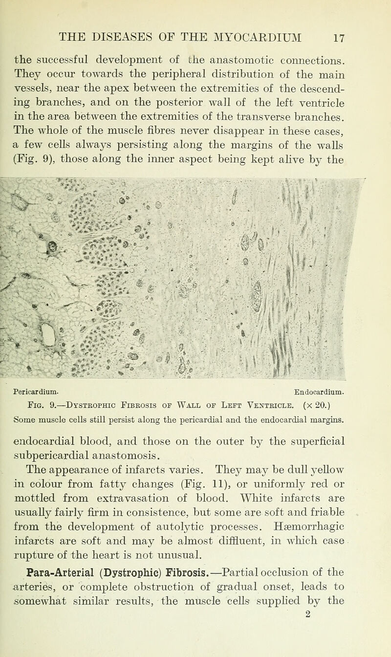 tlie successful development of the anastomotic connections. They occur towards the peripheral distribution of the main vessels, near the apex between the extremities of the descend- ing branches, and on the posterior wall of the left ventricle in the area between the extremities of the transverse branches. The whole of the muscle fibres never disappear in these cases, a few cells always persisting along the margins of the walls (Fig. 9), those along the inner aspect being kept aUve by the - ■;■ - . ;***>J'»> ■■ ^' Pericardium. Endocardium. Fig. 9.—Dysteophic Fibrosis of Wall op Left Venteicle. (x 20.) Some muscle cells still persist along tlie pericardial and the endocardial margins. endocardial blood, and those on the outer by the superficial subpericardial anastomosis. The appearance of infarcts varies. They may be dull yellow in colour from fatty changes (Fig. 11), or uniformly red or mottled from extravasation of blood. White infarcts are usually fairly firm in consistence, but some are soft and friable from the development of autolytic processes. Haemorrhagic infarcts are soft and may be almost diffluent, in Avhich case rupture of the heart is not unusual. Para-Arterial (Dystrophic) Fibrosis.—Partial occlusion of the arteries, or complete obstruction of gradual onset, leads to somewhat similar results, the muscle cells suppHed by the 2