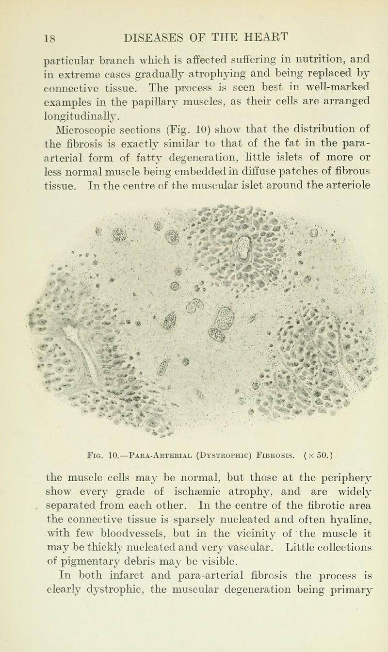 particular branch which is affected suffering in nutrition, and in extreme cases gradually atrophying and being replaced by connective tissue. The process is seen best in well-marked examples in the papillary muscles, as their cells are arranged longitudinally. ^Microscopic sections (Fig. 10) show that the distribution of the fibrosis is exactty similar to that of the fat in the para- arterial form of fatty degeneration, little islets of more or less normal muscle being embedded in diffuse patches of fibrous tissue. In the centre of the muscular islet around the arteriole )^;.-. ^^'^ '• 9 .^. -,' .«'jft ■•# ■ •• ■^*.-' -.•' .-r*','^*^ *■*■:- -» , ■ ii ■ .■ .*.■■•.'■•■' ' ' ■ ' », s.  -• Si ■ FiG. 10.—Paea-Aeterial (Dystrophic) Fibrosis. (x50. ) the muscle cells may be normal, but those at the periphery show every grade of ischaemic atrophy, and are widely separated from each other. In the centre of the fibrotic area the connective tissue is sparsely nucleated and often hyaline^ with few bloodvessels, but in the vicinit}^ of the muscle it may be thickly nucleated and very vascular. Little collections of pigmentary debris may be visible. In both infarct and para-arterial fibrosis the process is clearly dystrophic, the muscular degeneration being primary