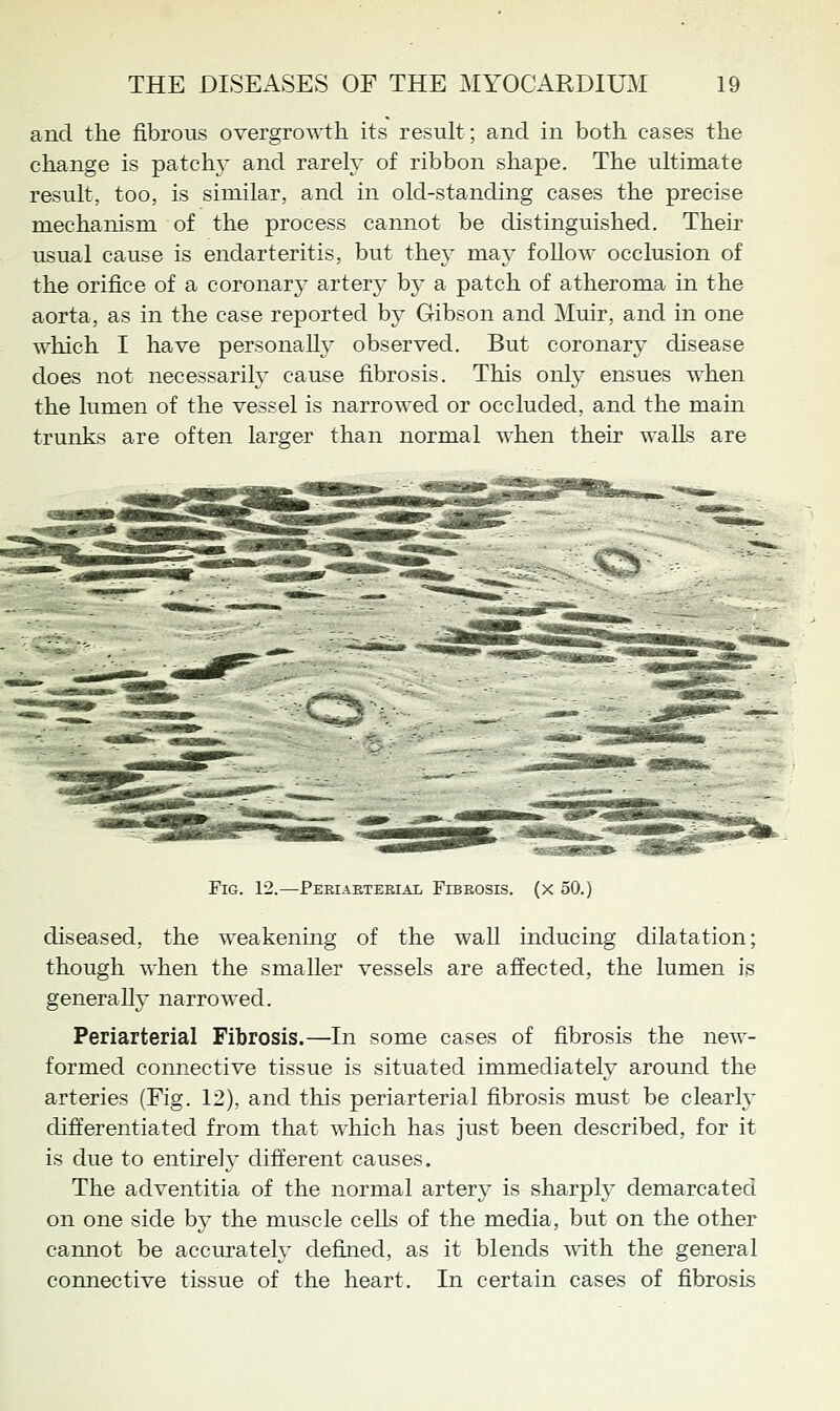 and the fibrous overgrowth its result; and in both cases the change is patchy and rarely of ribbon shape. The ultimate result, too, is similar, and in old-standing cases the precise mechanism of the process cannot be distinguished. Their usual cause is endarteritis, but they may follow occlusion of the orifice of a coronary artery by a patch of atheroma in the aorta, as in the case reported by Gibson and Muir, and in one which I have personaU}- observed. But coronary disease does not necessarily cause fibrosis. This only ensues when the lumen of the vessel is narrowed or occluded, and the main trunks are often larger than normal when their walls are Fig. 12.—Periaeterial Fibrosis, (x 50.) diseased, the weakening of the wall inducing dilatation; though when the smaller vessels are affected, the lumen is generally narrowed. Periarterial Fibrosis.—In some cases of fibrosis the new- formed connective tissue is situated immediately around the arteries (Fig. 12), and this periarterial fibrosis must be clearly differentiated from that which has just been described, for it is due to entirely cliff'erent causes. The adventitia of the normal artery is sharph' demarcated on one side by the muscle cells of the media, but on the other cannot be accurately defined, as it blends with the general connective tissue of the heart. In certain cases of fibrosis