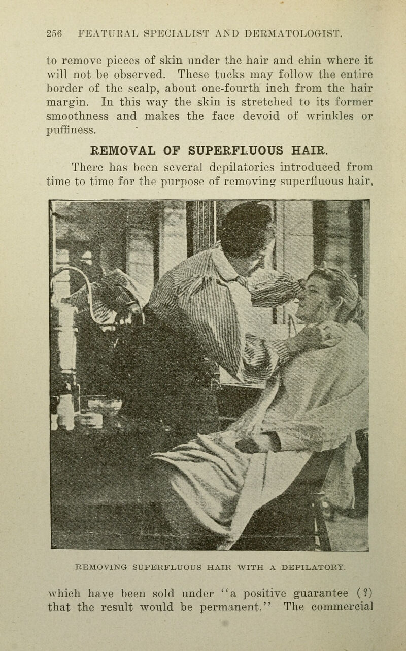 to remove pieces of skin under the hair and chin where it will not be observed. These tucks may follow the entire border of the scalp, about one-fourth inch from the hair margin. In this way the skin is stretched to its former smoothness and makes the face devoid of wrinkles or puffiness. REMOVAL OF SUPERFLUOUS HAIR. There has been several depilatories introduced from time to time for the purpose of removing superfluous hair, REMOVING SUPERFLUOUS HAIR WITH A DEPILATORY. which have been sold under a positive guarantee (?) that the result would be permanent. The commercial