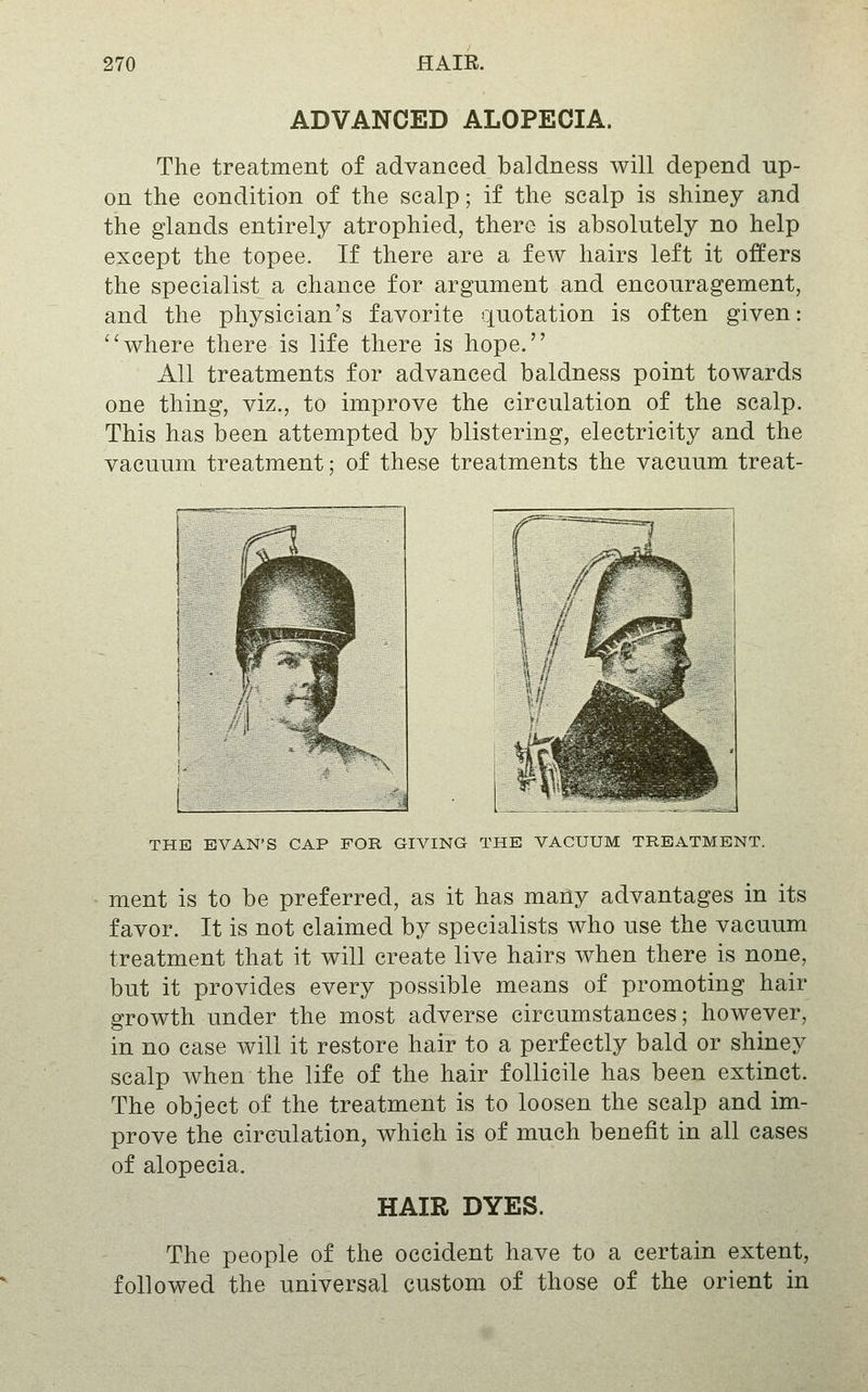 ADVANCED ALOPECIA. The treatment of advanced baldness will depend up- on the condition of the scalp; if the scalp is shiney and the glands entirely atrophied, there is absolutely no help except the topee. If there are a few hairs left it offers the specialist a chance for argument and encouragement, and the physician's favorite quotation is often given: ''where there is life there is hope. All treatments for advanced baldness point towards one thing, viz., to improve the circulation of the scalp. This has been attempted by blistering, electricity and the vacuum treatment; of these treatments the vacuum treat- 1 1 ' \ ,1 f ^^S \ 1 -- THE EVAN'S CAP FOR GIVING THE VACUUM TREATMENT. ment is to be preferred, as it has many advantages in its favor. It is not claimed by specialists who use the vacuum treatment that it will create live hairs when there is none, but it provides every possible means of promoting hair growth under the most adverse circumstances; however, in no case will it restore hair to a perfectly bald or shiney scalp when the life of the hair follicile has been extinct. The object of the treatment is to loosen the scalp and im- prove the circulation, which is of much benefit in all cases of alopecia. HAIR DYES. The people of the Occident have to a certain extent, followed the universal custom of those of the orient in