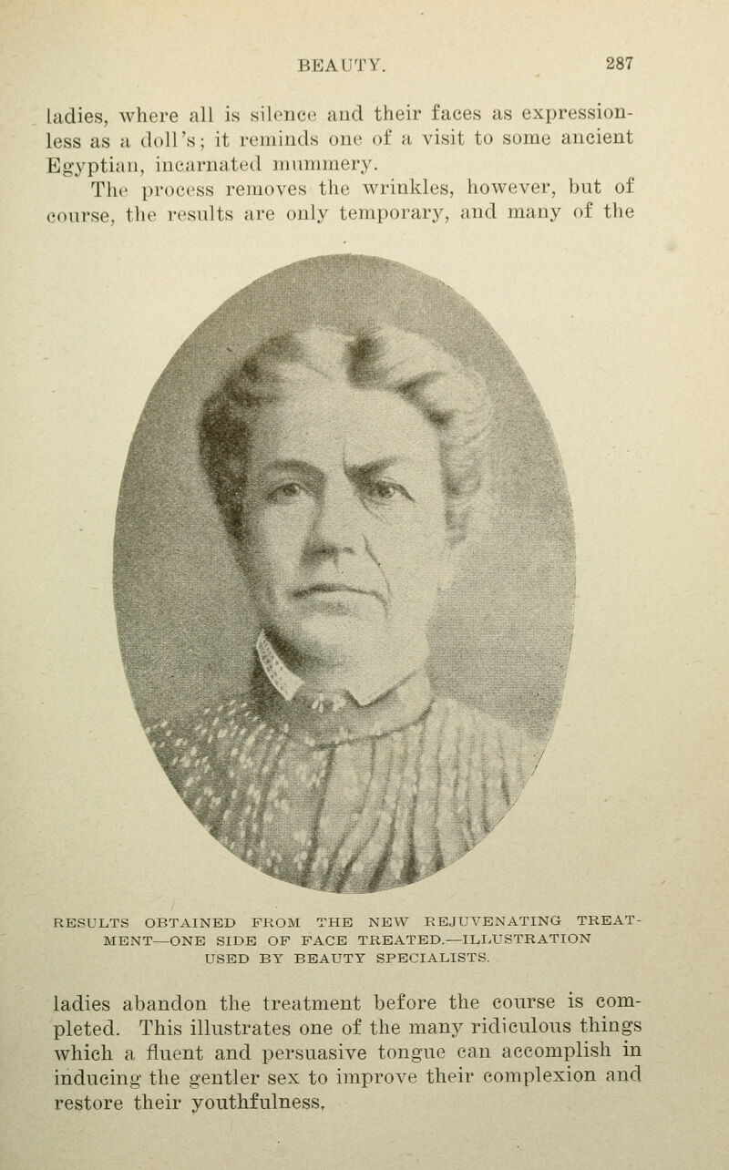 ladies, where all is silence and their faces as expression- less as a doll's; it reminds one of a visit to some ancient Egyptian, incarnated mummery. The process removes the wrinkles, however, but of course, the results are only temporary, and many of the RESULTS OBTAINED FROM THE NEW REJUVENATING TREAT- MENT—ONE SIDE OP FACE TREATED.—ILLUSTRATION USED BY BEAUTY SPECIALISTS. ladies abandon the treatment before the course is com- pleted. This illustrates one of the many ridiculous things which a fluent and persuasive tongue can accomplish in inducing the gentler sex to improve their complexion and restore their youthfulness,