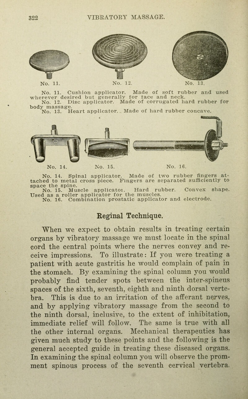 No. 11. No. 13. No. 11. Cushion applicator. Made of soft rubber and used wherever desired but generally for face and neck. No. 12. Disc applicator. Made of corrugated hard rubber for body massage. No. 13. Heart applicator.. Made of hard rubber concave. No. No. 15 No. 14. Spinal applicator. Made of tvi^o rubber fingers at- tached to metal cross piece. Fingers are separated sufficiently to space the spine. No. 15. Muscle applicatoi. Hard rubber. Convex shape. Used as a roller applicator for the muscles. No. 16. Combination prostatic applicator and electrode. Reginal Technique. When we expect to obtain results in treating certain organs by vibratory massage we must locate in the spinal cord the central points where the nerves convey and re- ceive impressions. To illustrate: If you were treating a patient with acute gastritis he would complain of pain in the stomach. By examining the spinal column you would probably find tender spots between the inter-spineus spaces of the sixth, seventh, eighth and ninth dorsal verte- bra. This is due to an irritation of the afferant nerves, and by applying vibratory massage from the second to the ninth dorsal, inclusive, to the extent of inhibitation, immediate relief will follow. The same is true with all the other internal organs. Mechanical therapeutics has given much study to these points and the following is the general accepted guide in treating these diseased organs. In examining the spinal column you will observe the prom- ment spinous process of the seventh cervical vertebra.