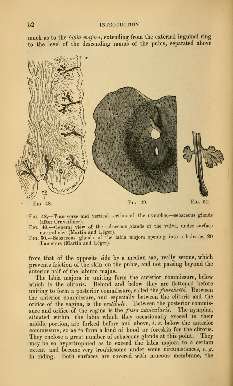 much as to the labia majora, extending from the external inguinal ring to the level of the descending ramus of the pubis, separated above ♦ ill'- 'rV-'Ip^iftTi Fig. 48. Fig. 49. Fig. 50. Fig. 48,—Transverse and vertical section of the nymphse,—sebaceous glands (after Cruveilhier). Fig. 49.—General view of the sebaceous glands of the vulva, under surface natural size (Martin and Leger). Fig. 50.—Sebaceous glands of the labia majora opening into a hair-sac, 20 diameters (Martin and Leger). from that of the opposite side by a median sac, really serous, which prevents friction of the skin on the pubis, and not passing beyond the anterior half of the labium majus. The labia majora in uniting form the anterior commissure, below which is the clitoris. Behind and below they are flattened before uniting to form a posterior commissure, called ihtfourchette. Between the anterior commissure, and especially between the clitoris and the orifice of the vagina, is the vestibule. Between the posterior commis- sure and orifice of the vagina is the fossa navicularis. The nymphse, situated within the labia which they occasionally exceed in their middle portion, are forked before and above, i. e. below the anterior commissure, so as to form a kind of hood or foreskin for the clitoris. They enclose a great number of sebaceous glands at this point. They may be so hypertrophied as to exceed the labia majora to a certain extent and become very troublesome under some circumstances, e. g. in riding. Both surfaces are covered witli mucous membrane, the