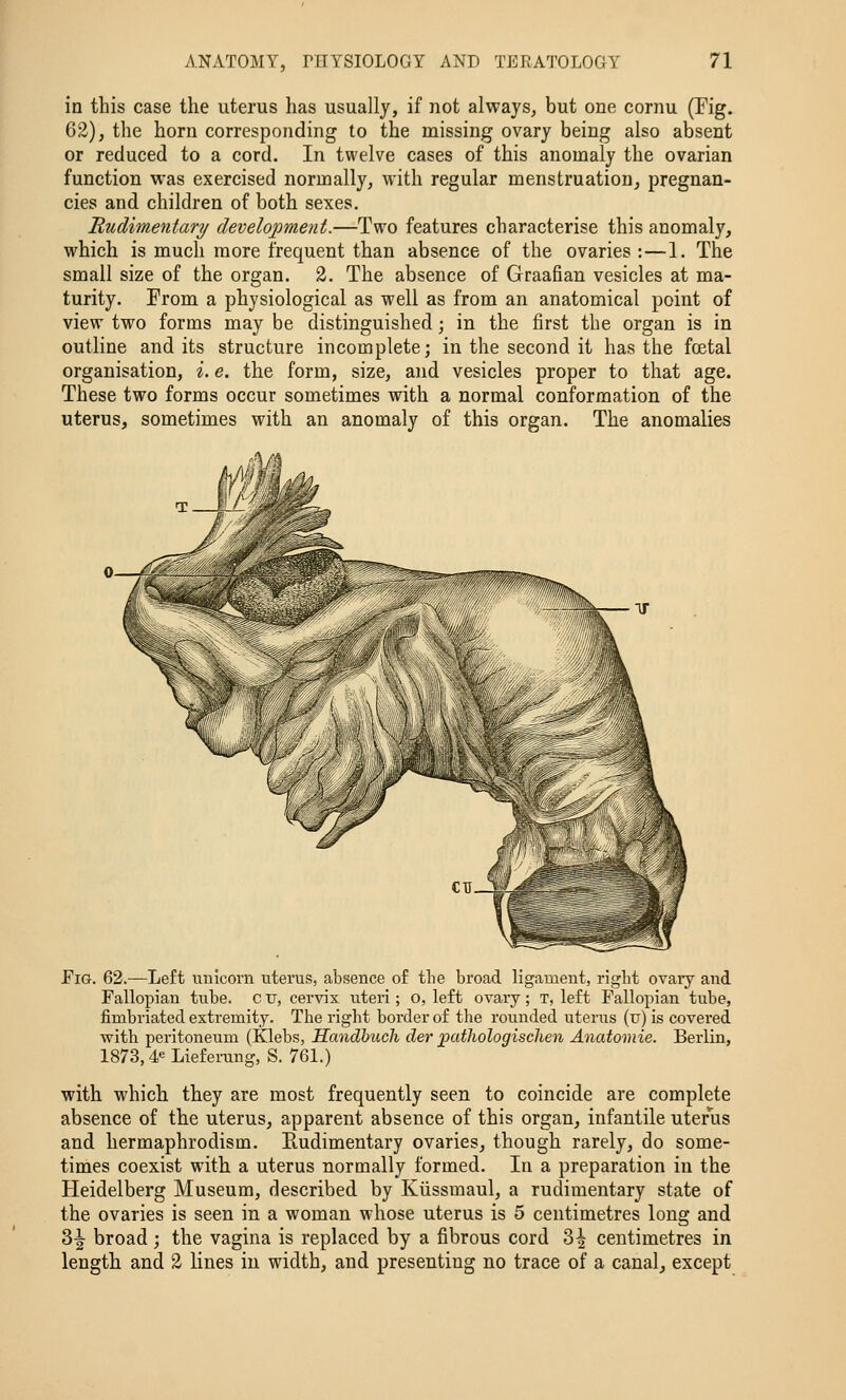 in this case the uterus has usually, if not always, but one cornu (Fig. 62), the horn corresponding to the missing ovary being also absent or reduced to a cord. In twelve cases of this anomaly the ovarian function vi-as exercised normally, with regular menstruation, pregnan- cies and children of both sexes. Rudimentary development.—Two features characterise this anomaly, which is much more frequent than absence of the ovaries :—1. The small size of the organ. 2. The absence of Graafian vesicles at ma- turity. From a physiological as well as from an anatomical point of view two forms may be distinguished; in the first the organ is in outline audits structure incomplete; in the second it has the foetal organisation, i. e. the form, size, and vesicles proper to that age. These two forms occur sometimes with a normal conformation of the uterus, sometimes with an anomaly of this organ. The anomalies Fig. 62.—Left unicorn uterus, absence of tlie broad ligament, right ovaiy and Fallopian tube, c tr, cervix uteri; o, left ovary; T, left Fallopian tube, fimbriated extremity. The right border of the rounded uterus (u) is covered with peritoneum (Klebs, Handbuch der pathologischen Anatomie. Berlin, 1873,4«= Lieferung, S. 761.) with which they are most frequently seen to coincide are complete absence of the uterus, apparent absence of this organ, infantile uterus and hermaphrodism. Rudimentary ovaries, though rarely, do some- times coexist with a uterus normally formed. In a preparation in the Heidelberg Museum, described by Kiissmaul, a rudimentary state of the ovaries is seen in a woman whose uterus is 5 centimetres long and 3^ broad; the vagina is replaced by a fibrous cord 3^ centimetres in length and 2 lines in width, and presenting no trace of a canal, except