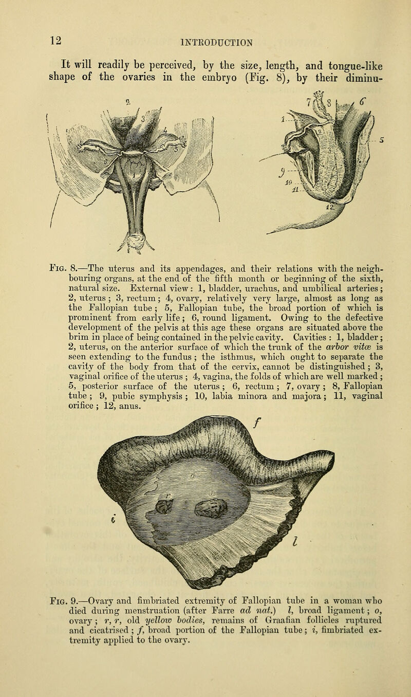 It will readily be perceived, by the size, lengtb^ and tongue-like shape of the ovaries in the embryo (Pig. 8)^ by their dimiuu- FiG. 8,—The uterus and its appendages, and their relations with the neigh- houring organs, at the end of the fifth month or beginning of the sixth, natural size. External view: 1, bladder, urachus, and umbilical arteries ; 2, utems; 3, rectum; 4, ovaiy, relatively very large, almost as long as the Fallopian tube ; 5, Fallopian tube, the broad portion of which is prominent from early life; 6, round ligament. Owing to the defective development of the pelvis at this age these organs are situated above the brim in place of being contained in the pelvic cavity. Cavities : 1, bladder; 2, uterus, on the anterior surface of which the trunk of the arbor vitce is seen extending to the fundus ; the isthmus, which ought to separate the cavity of the body from that of the cervix, cannot be distinguished ; 3, vaginal orifice of the uteras ; 4, vagina, the folds of which are well marked ; 5, posterior surface of the uteras ; 6, rectum ; 7, ovaiy ; 8, Fallopian tube ; 9, pubic symphysis ; 10, labia minora and majora; 11, vaginal orifice; 12, anus. Fig. 9.—Ovary and fimbriated extremity of Fallopian tube in a woman who died during menstruation (after Farre ad nat.) I, broad ligament; o, ovary; r, r, old yellow bodies, remains of Graafian follicles ruptured and cicatrised ; /, broad portion of the Fallopian tube; i, fimbriated ex- tremity applied to the ovary.