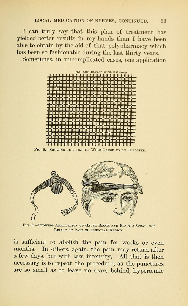 I can truly say that this plan of treatment has yielded better results in my hands than I have been able to obtain by the aid of that polypharmacy which has been so fashionable during the last thirty years. Sometimes, in uncomplicated cases, one application MAZARO.HAZARO.aCO.W.F.FORO Fig. 5.—Showing the kind of Wire Gauze to be Employed. Fig. 6.—Showing Application of Gauze Block and Elastic Strap, for Relief of Pain in Temporal Region. is sufficient to abolish the pain for weeks or even months. In others, again, the pain may return after a few days, but with less intensity. All that is then necessary is to repeat the procedure, as the punctures are so small as to leave no scars behind, hyperasmic