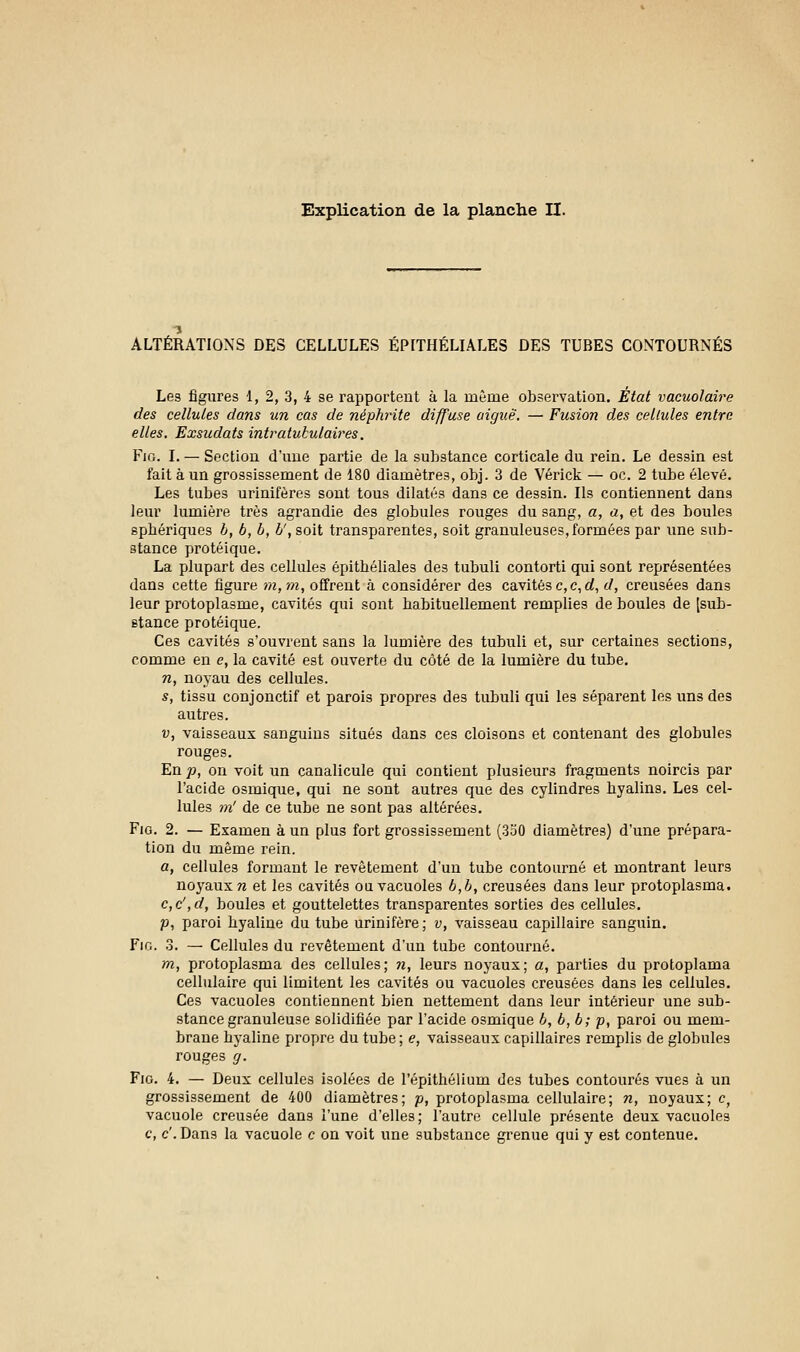 ALTÉRATIONS DES CELLULES ÉPITHÉLIALES DES TUBES CONTOURNÉS Les figures 1, 2, 3, 4 se rapportent à la même observation. État vacuolaire des cellules dans un cas de néphrite diffuse aiguë. — Fusion des cellules entre elles. Exsudats intratubulaires. Fio. I. — Section d'une partie de la substance corticale du rein. Le dessin est fait à un grossissement de 180 diamètres, obj. 3 de Vérick — oc. 2 tube élevé. Les tubes urinifères sont tous dilatés dans ce dessin. Ils contiennent dans leur lumière très agrandie des globules rouges du sang, a, a, et des boules spbériques b, b, b, b', soit transparentes, soit granuleuses,formées par une sub- stance protéique. La plupart des cellules épitbéliales des tubuli contorti qui sont représentées dan3 cette figure m, m, offrent à considérer des cavités c, c, d, d, creusées dans leur protoplasme, cavités qui sont habituellement remplies de boules de [sub- stance protéique. Ces cavités s'ouvrent sans la lumière des tubuli et, sur certaines sections, comme en e, la cavité est ouverte du côté de la lumière du tube. n, noyau des cellules. s, tissu conjonctif et parois propres des tubuli qui les séparent les uns des autres. v, vaisseaux sanguins situés dans ces cloisons et contenant des globules rouges. En p, on voit un canalicule qui contient plusieurs fragments noircis par l'acide osmique, qui ne sont autres que des cylindres hyalins. Les cel- lules m' de ce tube ne sont pas altérées. Fio. 2. — Examen à un plus fort grossissement (3o0 diamètres) d'une prépara- tion du même rein. a, cellules formant le revêtement d'un tube contourné et montrant leurs noyaux n et les cavités ou vacuoles b,b, creusées dans leur protoplasma. c,c',d, boules et gouttelettes transparentes sorties des cellules. p, paroi hyaline du tube urinifère; v, vaisseau capillaire sanguin. Fio. 3. — Cellules du revêtement d'un tube contourné. m, protoplasma des cellules; n, leurs noyaux; a, parties du protoplama cellulaire qui limitent les cavités ou vacuoles creusées dans les cellules. Ces vacuoles contiennent bien nettement dans leur intérieur une sub- stance granuleuse solidifiée par l'acide osmique b, b, b; p, paroi ou mem- brane hyaline propre du tube; e, vaisseaux capillaires remplis de globules rouges g. Fio. 4. — Deux cellules isolées de l'épithélium des tubes contourés vues à un grossissement de 400 diamètres; p, protoplasma cellulaire; n, noyaux; cf vacuole creusée dans l'une d'elles; l'autre cellule présente deux vacuoles c, c'. Dans la vacuole c on voit une substance grenue qui y est contenue.