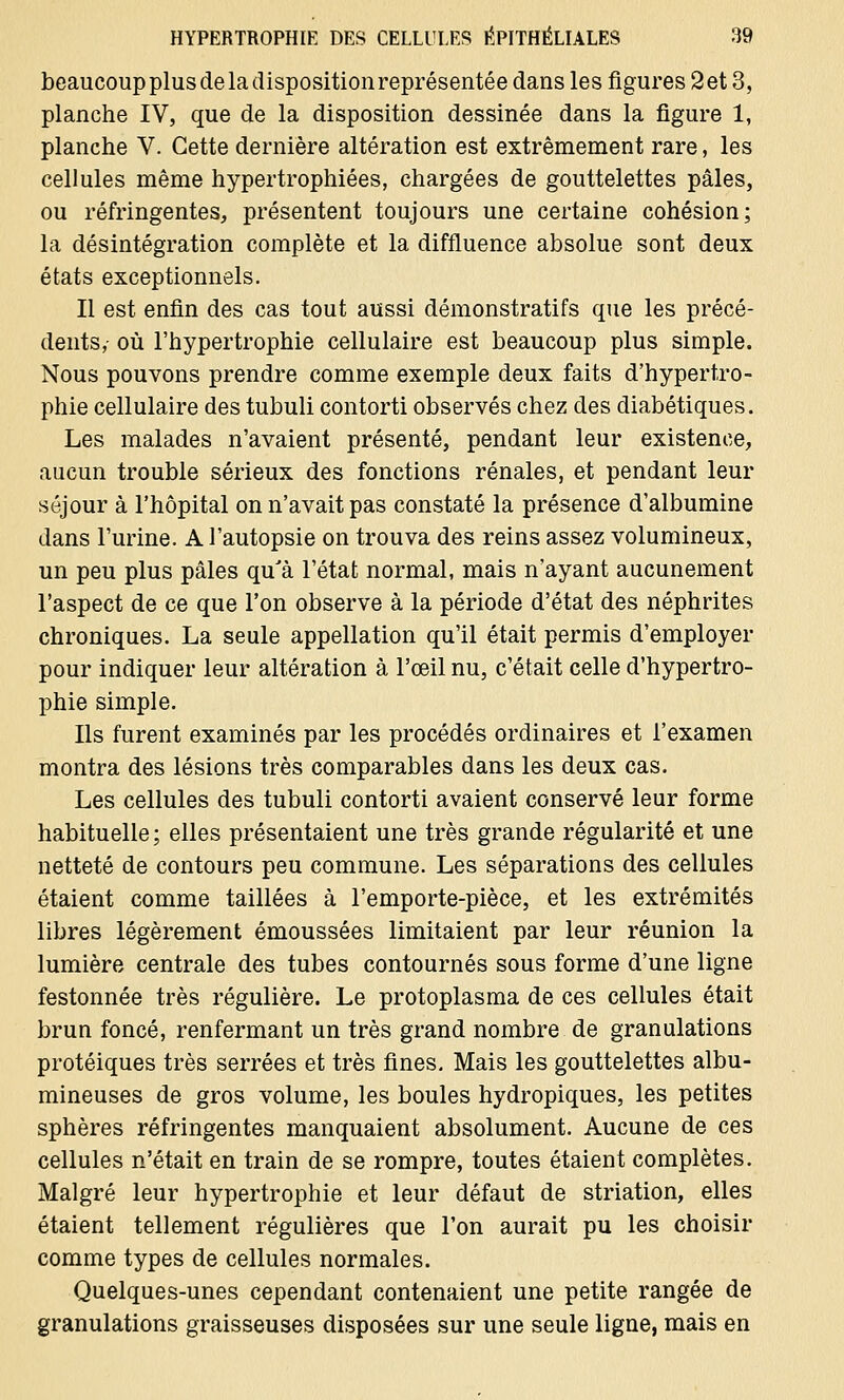 beaucoup plus de la dispositionreprésentée dans les figures 2et 3, planche IV, que de la disposition dessinée dans la figure 1, planche V. Cette dernière altération est extrêmement rare, les cellules même hypertrophiées, chargées de gouttelettes pâles, ou réfringentes, présentent toujours une certaine cohésion; la désintégration complète et la diffluence absolue sont deux états exceptionnels. Il est enfin des cas tout aussi démonstratifs que les précé- dents, où l'hypertrophie cellulaire est beaucoup plus simple. Nous pouvons prendre comme exemple deux faits d'hypertro- phie cellulaire des tubuli contorti observés chez des diabétiques. Les malades n'avaient présenté, pendant leur existence, aucun trouble sérieux des fonctions rénales, et pendant leur séjour à l'hôpital on n'avait pas constaté la présence d'albumine dans l'urine. A l'autopsie on trouva des reins assez volumineux, un peu plus pâles qu'à l'état normal, mais n'ayant aucunement l'aspect de ce que l'on observe à la période d'état des néphrites chroniques. La seule appellation qu'il était permis d'employer pour indiquer leur altération à l'œil nu, c'était celle d'hypertro- phie simple. Ils furent examinés par les procédés ordinaires et l'examen montra des lésions très comparables dans les deux cas. Les cellules des tubuli contorti avaient conservé leur forme habituelle ; elles présentaient une très grande régularité et une netteté de contours peu commune. Les séparations des cellules étaient comme taillées à l'emporte-pièce, et les extrémités libres légèrement émoussées limitaient par leur réunion la lumière centrale des tubes contournés sous forme d'une ligne festonnée très régulière. Le protoplasma de ces cellules était brun foncé, renfermant un très grand nombre de granulations protéiques très serrées et très fines. Mais les gouttelettes albu- mineuses de gros volume, les boules hydropiques, les petites sphères réfringentes manquaient absolument. Aucune de ces cellules n'était en train de se rompre, toutes étaient complètes. Malgré leur hypertrophie et leur défaut de striation, elles étaient tellement régulières que l'on aurait pu les choisir comme types de cellules normales. Quelques-unes cependant contenaient une petite rangée de granulations graisseuses disposées sur une seule ligne, mais en