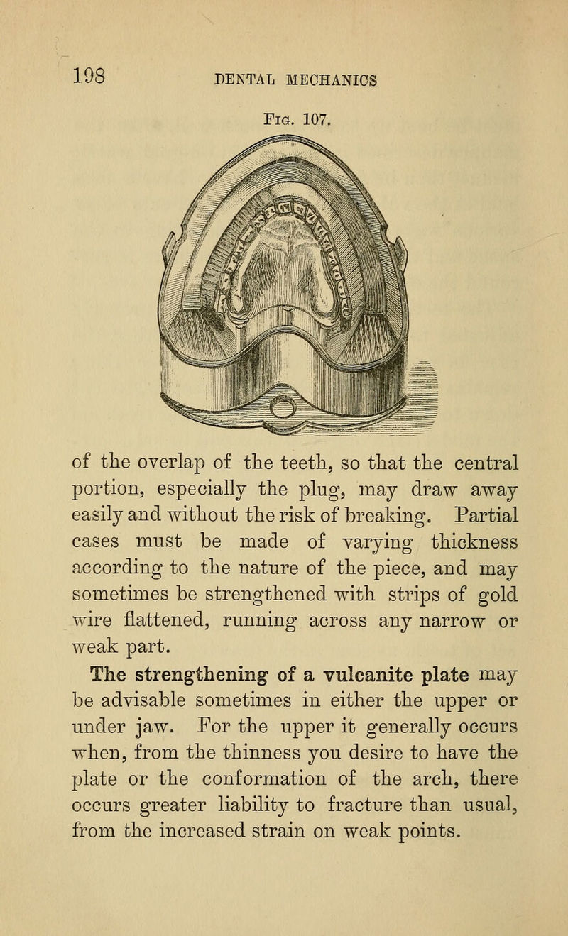 Fig. 107. of the overlap of the teeth, so that the central portion, especially the plug, may draw away easily and without the risk of breaking. Partial cases must be made of varying thickness according to the nature of the piece, and may sometimes be strengthened with strips of gold wire flattened, running across any narrow or weak part. The strengthening of a vulcanite plate may be advisable sometimes in either the upper or under jaw. For the upper it generally occurs when, from the thinness you desire to have the plate or the conformation of the arch, there occurs greater liability to fracture than usual, from the increased strain on weak points.