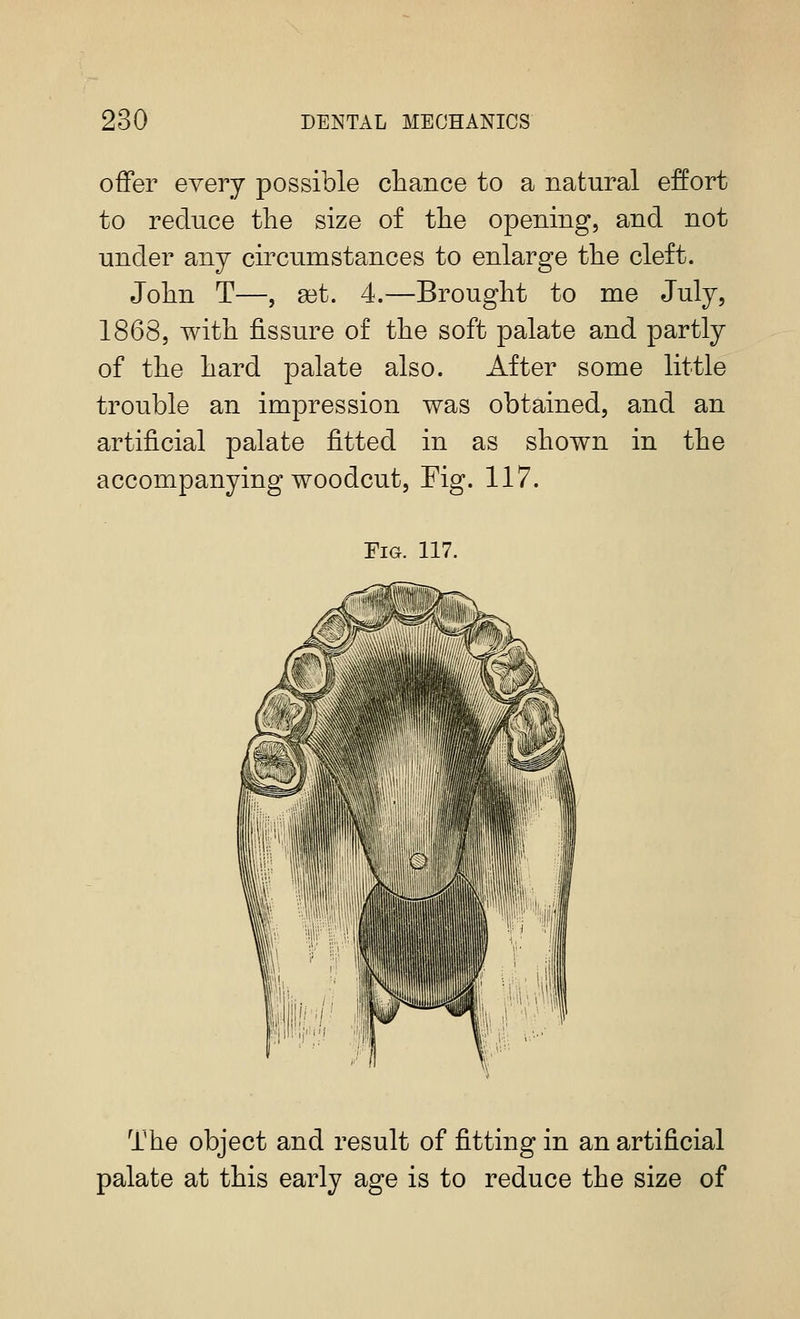 offer eyery possible chance to a natural effort to reduce the size of the opening, and not under any circumstances to enlarge the cleft. John T—, get. 4.—Brought to me July, 1868, with fissure of the soft palate and partly of the hard jDalate also. After some little trouble an impression was obtained, and an artificial palate fitted in as shown in the accompanying woodcut, Fig. 117. Fig. 117. The object and result of fitting in an artificial palate at this early age is to reduce the size of