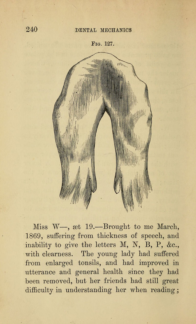 Fig. 127. Miss W—5 set 19.—Brought to me March, 1869, suffering from thickness of speech, and inability to give the letters M, 'N, B, P, &c., with clearness. The young lady had suffered from enlarged tonsils, and had improved in utterance and general health since they had been removed, but her friends had still great difficulty in understanding her when reading;