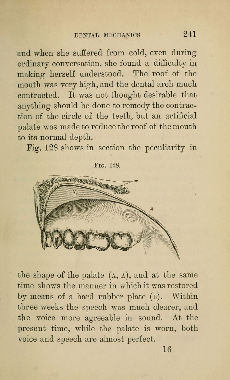 and wlien slie suffered from cold, even during ordinary conversation, slie found a difficulty in making herself understood. The roof of the mouth was very high, and the dental arch much contracted. It was not thought desirable that anything should be done to remedy the contrac- tion of the circle of the teeth, but an artificial palate was made to reduce the roof of the mouth to its normal depth. Fig. 128 shows in section the peculiarity in Fig. 128. the shape of the palate (a, a), and at the same time shows the manner in which it was restored by means of a hard rubber plate (b). Within three weeks the speech was much clearer, and the voice more asrreeable in sound. At the present time, while the palate is worn, both voice and speech are almost perfect. 16