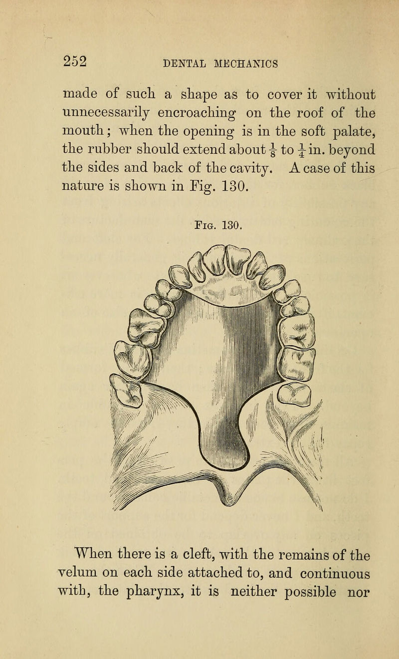 made of such a shape as to cover it without unnecessarily encroaching on the roof of the mouth; when the opening is in the soft palate, the rubber should extend about ^ to Jin. beyond the sides and back of the cavity. A case of this nature is shown in Fig. 130. Fig. 130. When there is a cleft, with the remains of the velum on each side attached to, and continuous with, the pharynx, it is neither possible nor