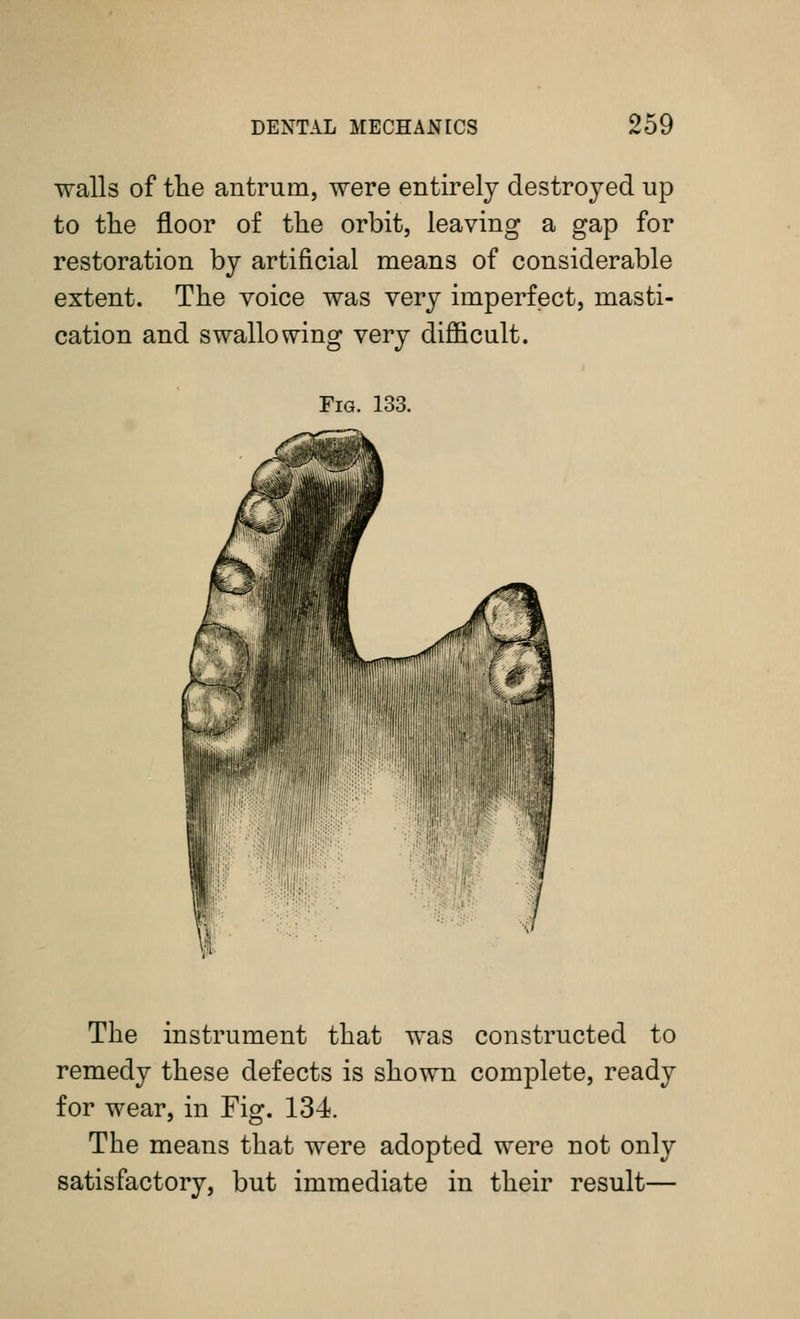 walls of tlie antrum, were entirely destroyed up to the floor of the orbit, leaving a gap for restoration by artificial means of considerable extent. The voice was very imperfect, masti- cation and swallowing very difficult. Fig. 133. The instrument that was constructed to remedy these defects is shown complete, ready for wear, in Fig. 134. The means that were adopted were not only satisfactory, but immediate in their result—