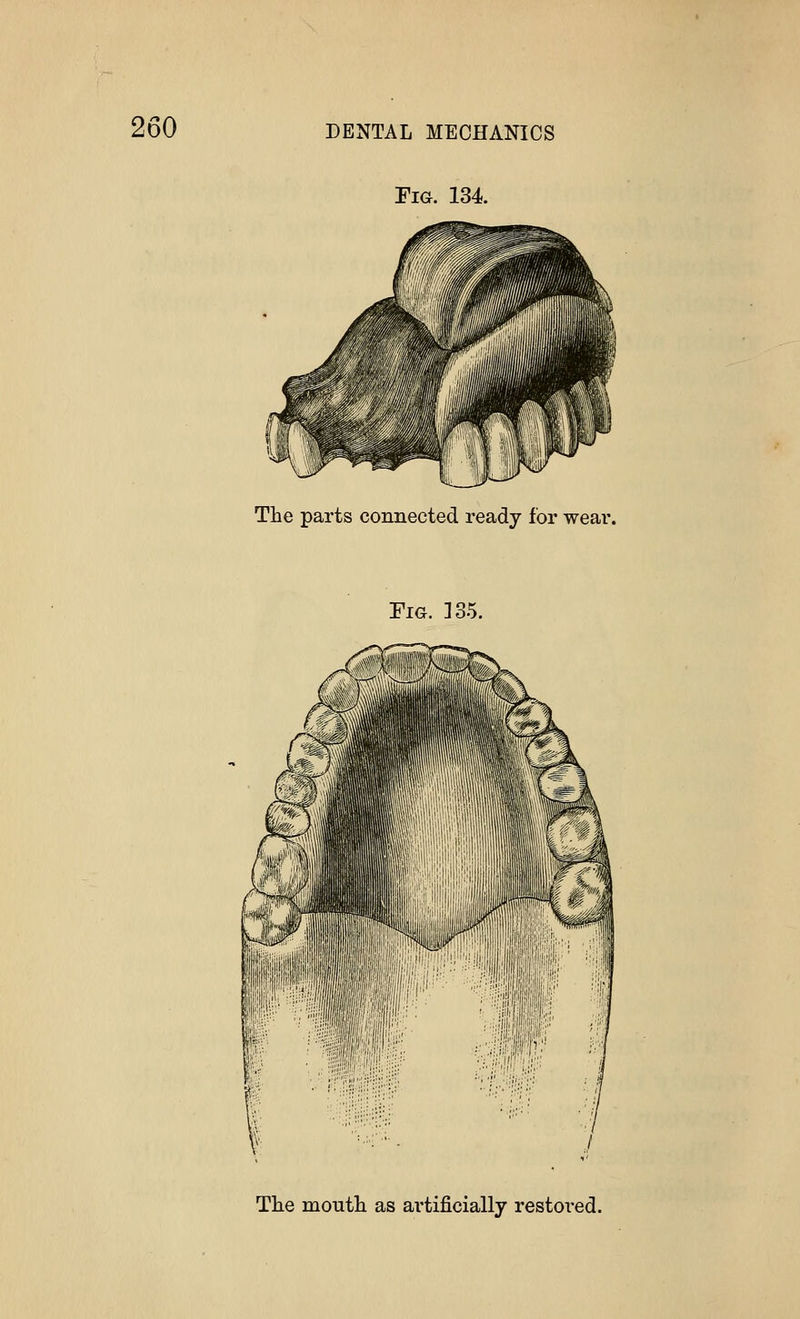 Fig. 134. The parts connected ready for wear. Fig. ]35. The mouth as artificially restored.