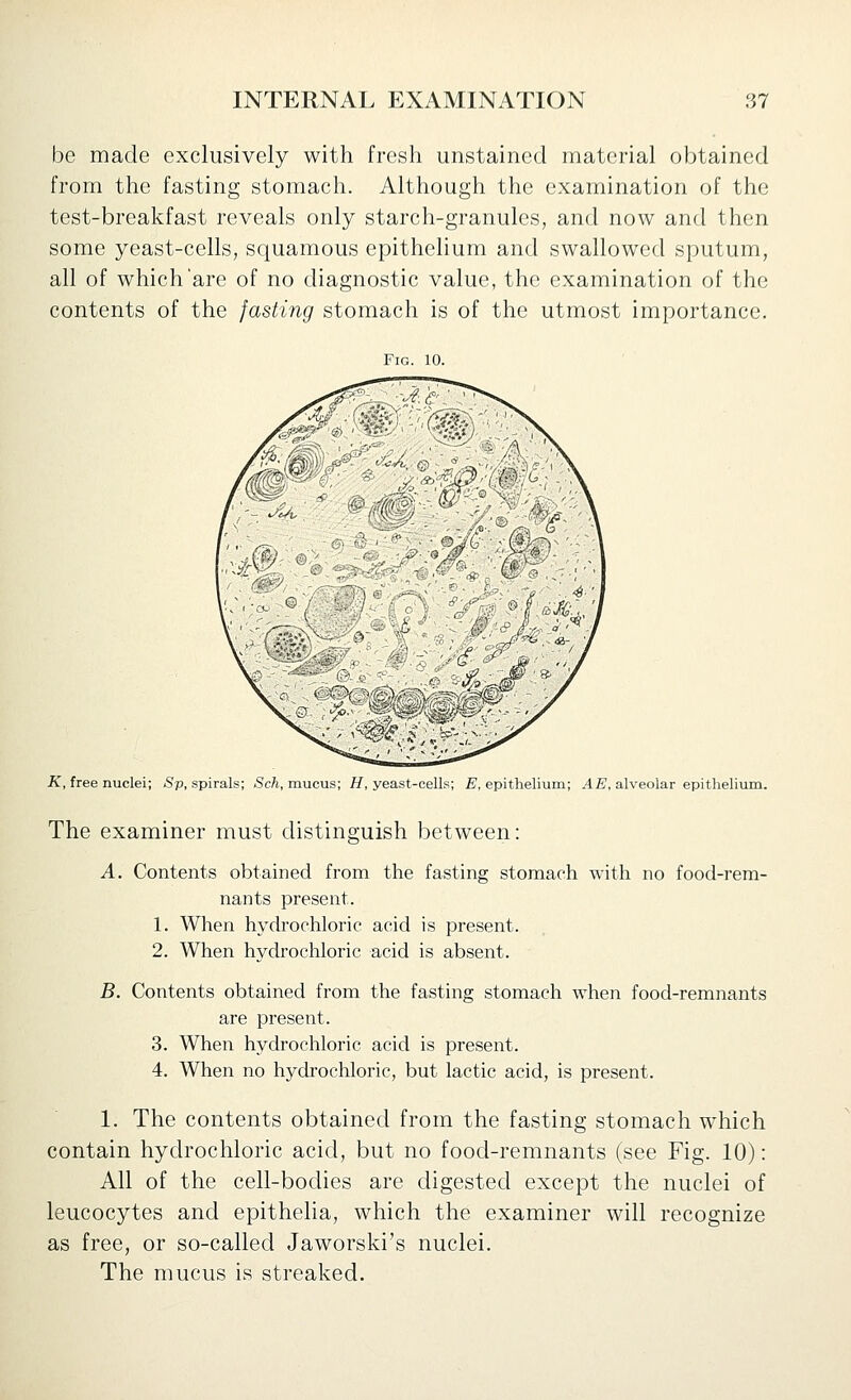 be made exclusively with fresh unstained material obtained from the fasting stomach. Although the examination of the test-breakfast reveals only starch-granules, and now and then some yeast-cells, squamous epithelium and swallowed sputum, all of which'are of no diagnostic value, the examination of the contents of the fasting stomach is of the utmost importance. Fig. 10. X, free nuclei; <Sp, spirals; -Scft, mucus; H, yeast-cells; iJ, epithelium; Afi, alveolar epithelium. The examiner must distinguish between: A. Contents obtained from the fasting stomach with no food-rem- nants present. 1. When hydrochloric acid is present. 2. When hydrochloric acid is absent. B. Contents obtained from the fasting stomach when food-remnants are present. 3. When hydrochloric acid is present. 4. When no hydrochloric, but lactic acid, is present. 1. The contents obtained from the fasting stomach which contain hydrochloric acid, but no food-remnants (see Fig. 10): All of the cell-bodies are digested except the nuclei of leucocytes and epithelia, which the examiner will recognize as free, or so-called Jaworski's nuclei. The mucus is streaked.