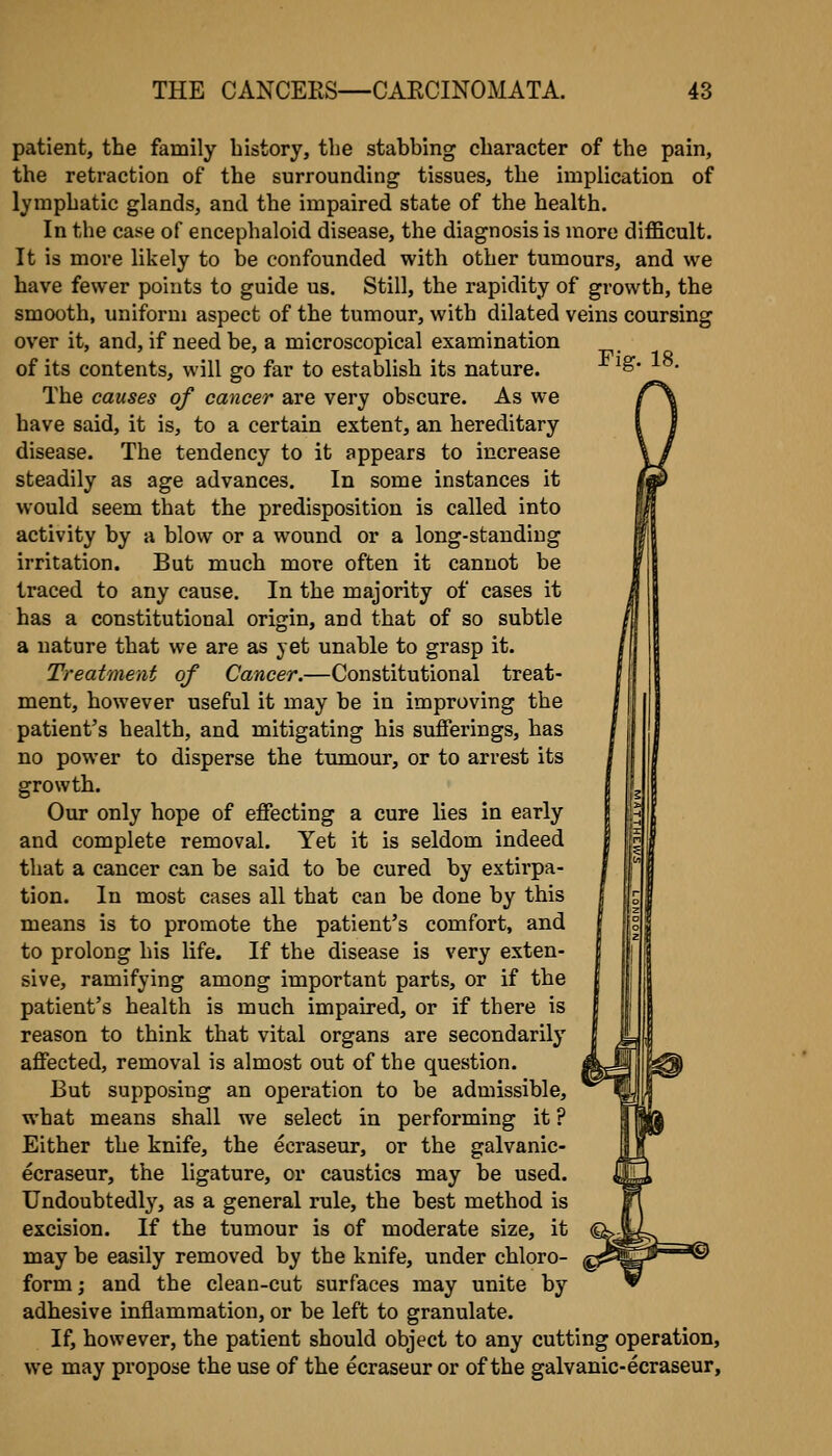 patient, the family history, the stabbing character of the pain, the retraction of the surrounding tissues, the implication of lymphatic glands, and the impaired state of the health. In the case of encephaloid disease, the diagnosis is more difficult. It is more likely to be confounded with other tumours, and we have fewer points to guide us. Still, the rapidity of growth, the smooth, uniform aspect of the tumour, with dilated veins coursing over it, and, if need be, a microscopical examination ^. of its contents, will go far to establish its nature. The causes of cancer are very obscure. As we have said, it is, to a certain extent, an hereditary disease. The tendency to it appears to increase steadily as age advances. In some instances it would seem that the predisposition is called into activity by a blow or a wound or a long-standing irritation. But much more often it cannot be traced to any cause. In the majority of cases it has a constitutional origin, and that of so subtle a nature that we are as yet unable to grasp it. Treatment of Cancer.—Constitutional treat- ment, however useful it may be in improving the patient's health, and mitigating his sufferings, has no power to disperse the tumour, or to arrest its growth. Our only hope of effecting a cure lies in early and complete removal. Yet it is seldom indeed that a cancer can be said to be cured by extirpa- tion. In most cases all that can be done by this means is to promote the patient's comfort, and to prolong his life. If the disease is very exten- sive, ramifying among important parts, or if the patient's health is much impaired, or if there is reason to think that vital organs are secondarily affected, removal is almost out of the question. But supposing an operation to be admissible, what means shall we select in performing it ? Either the knife, the ecraseur, or the galvanic- ecraseur, the ligature, or caustics may be used. Undoubtedl}-^, as a general rule, the best method is excision. If the tumour is of moderate size, it may be easily removed by the knife, under chloro- form; and the clean-cut surfaces may unite by adhesive inflammation, or be left to granulate. If, however, the patient should object to any cutting operation, we may propose the use of the ecraseur or of the galvanic-ecraseur.