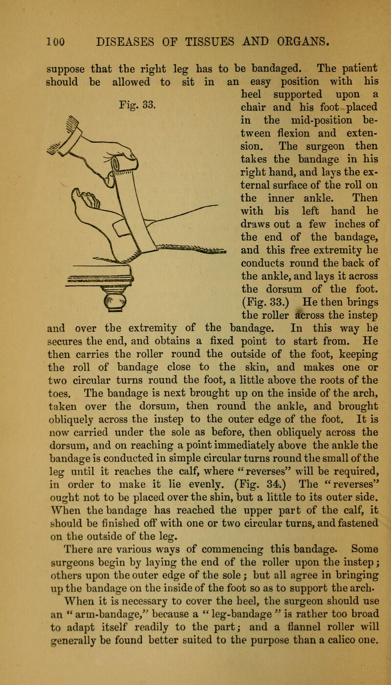 suppose that the right leg has to he bandaged. The patient should be allowed to sit in an easy position with his heel supported upon a Fig. 33. chair and his foot placed in the mid-position be- tween flexion and exten- sion. The surgeon then takes the bandage in his right hand, and lays the ex- ternal surface of the roU on the inner ankle. Then with his left hand he draws out a few inches of the end of the bandage, and this free extremity he conducts round the back of the ankle, and lays it across the dorsum of the foot. (Fig. 33.) He then brings the roUer across the instep and over the extremity of the bandage. In this way he secures the end, and obtains a fixed point to start from. He then carries the roller round the outside of the foot, keeping the roll of bandage close to the skin, and makes one or two circular turns round the foot, a little above the roots of the toes. The bandage is next brought up on the inside of the arch, taken over the dorsum, then round the ankle, and brought obliquely across the instep to the outer edge of the foot. It is now carried under the sole as before, then obliquely across the dorsum, and on reaching a point immediately above the ankle the bandage is conducted in simple circular turns round the small of the leg until it reaches the calf, where  reverses will be required, in order to make it lie evenly. (Fig. 34.) The reverses ought not to be placed over the shin, but a little to its outer side. When the bandage has reached the upper part of the calf, it should be finished ofi with one or two circular turns, and fastened on the outside of the leg. There are various ways of commencing this bandage. Some surgeons begin by laying the end of the roller upon the instep j others upon the outer edge of the sole; but all agree in bringing up the bandage on the inside of the foot so as to support the arch- When it is necessary to cover the heel, the surgeon should use an  arm-bandage, because a  leg-bandage  is rather too broad to adapt itself readily to the part; and a flannel roller will generally be found better suited to the purpose than a calico one.