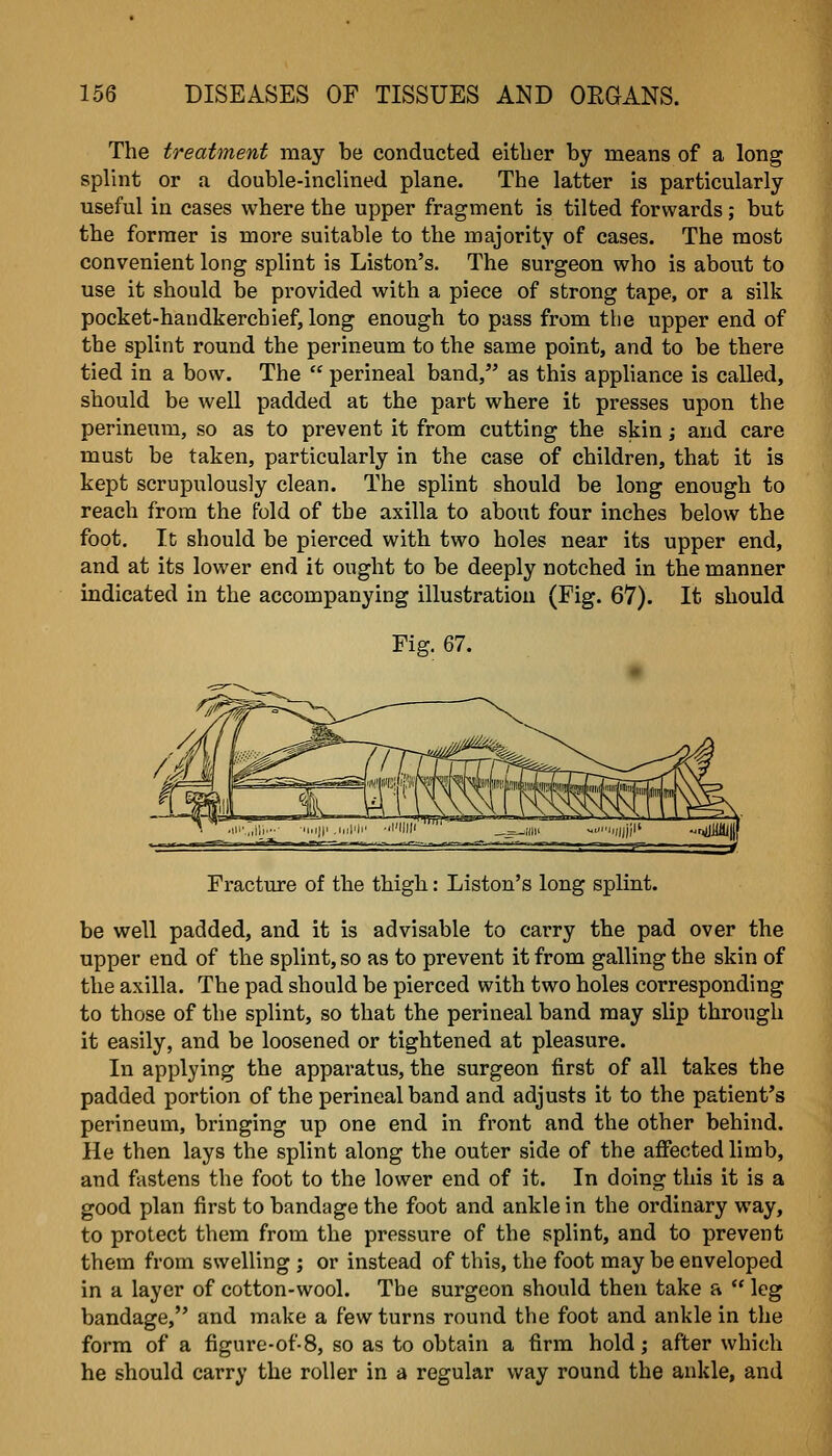 The treatment may be conducted either by means of a long splint or a double-inclined plane. The latter is particularly useful in cases where the upper fragment is tilted forwards; but the former is more suitable to the majority of cases. The most convenient long splint is Liston's. The surgeon who is about to use it should be provided with a piece of strong tape, or a silk pocket-handkerchief, long enough to pass from tiie upper end of the splint round the perineum to the same point, and to be there tied in a bow. The  perineal band, as this appliance is called, should be well padded at the part where it presses upon the perineum, so as to prevent it from cutting the skin; and care must be taken, particularly in the case of children, that it is kept scrupulously clean. The splint should be long enough to reach from the fold of the axilla to about four inches below the foot. It should be pierced with two holes near its upper end, and at its lower end it ought to be deeply notched in the manner indicated in the accompanying illustration (Fig. 67). It should Fig. 67. Fracture of the thigh: Liston's long splint. be well padded, and it is advisable to carry the pad over the upper end of the splint, so as to prevent it from galling the skin of the axilla. The pad should be pierced with two holes corresponding to those of the splint, so that the perineal band may slip through it easily, and be loosened or tightened at pleasure. In applying the apparatus, the surgeon first of all takes the padded portion of the perineal band and adjusts it to the patient's perineum, bringing up one end in front and the other behind. He then lays the splint along the outer side of the aifected limb, and fastens the foot to the lower end of it. In doing this it is a good plan first to bandage the foot and ankle in the ordinary way, to protect them from the pressure of the splint, and to prevent them from swelling ; or instead of this, the foot may be enveloped in a layer of cotton-wool. The surgeon should then take a  leg bandage, and make a few turns round the foot and ankle in the form of a figure-of8, so as to obtain a firm hold; after which he should carry the roller in a regular way round the ankle, and