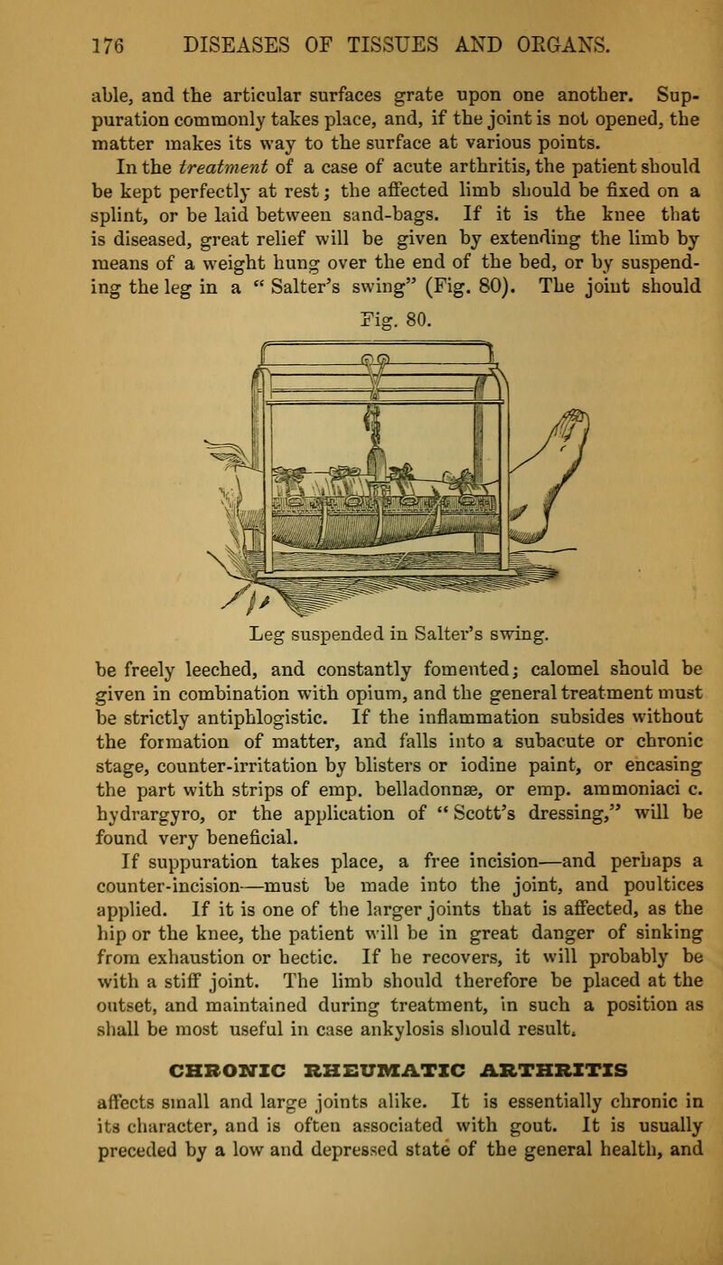 able, and the articular surfaces grate upon one another. Sup- puration commonly takes place, and, if the joint is not opened, the matter makes its way to the surface at various points. In the treatment of a case of acute arthritis, the patient should be kept perfectly at rest; the affected limb should be fixed on a sphnt, or be laid between sand-bags. If it is the knee that is diseased, great relief will be given by extending the limb by means of a weight hung over the end of the bed, or by suspend- ing the leg in a  Salter's swing (Fig. 80). The joint should Fis-. 80. Leg suspended in Salter's swing. be freely leeched, and constantly fomented; calomel should be given in combination with opium, and the general treatment must be strictly antiphlogistic. If the inflammation subsides without the formation of matter, and falls into a subacute or chronic stage, counter-irritation by blisters or iodine paint, or encasing the part with strips of emp. belladonnae, or emp. ammoniaci c. hydrargyro, or the application of  Scott's dressing, will be found very beneficial. If suppuration takes place, a free incision—and perhaps a counter-incision—must be made into the joint, and poultices applied. If it is one of the larger joints that is affected, as the hip or the knee, the patient will be in great danger of sinking from exhaustion or hectic. If he recovers, it will probably be with a stiff joint. The limb should therefore be placed at the outset, and maintained during treatment, in such a position as shall be most useful in case ankylosis should result. CHBON-ZC RHEUMATIC ARTHRITIS affects small and large joints alike. It is essentially chronic in its character, and is often associated with gout. It is usually preceded by a low and depressed state of the general health, and